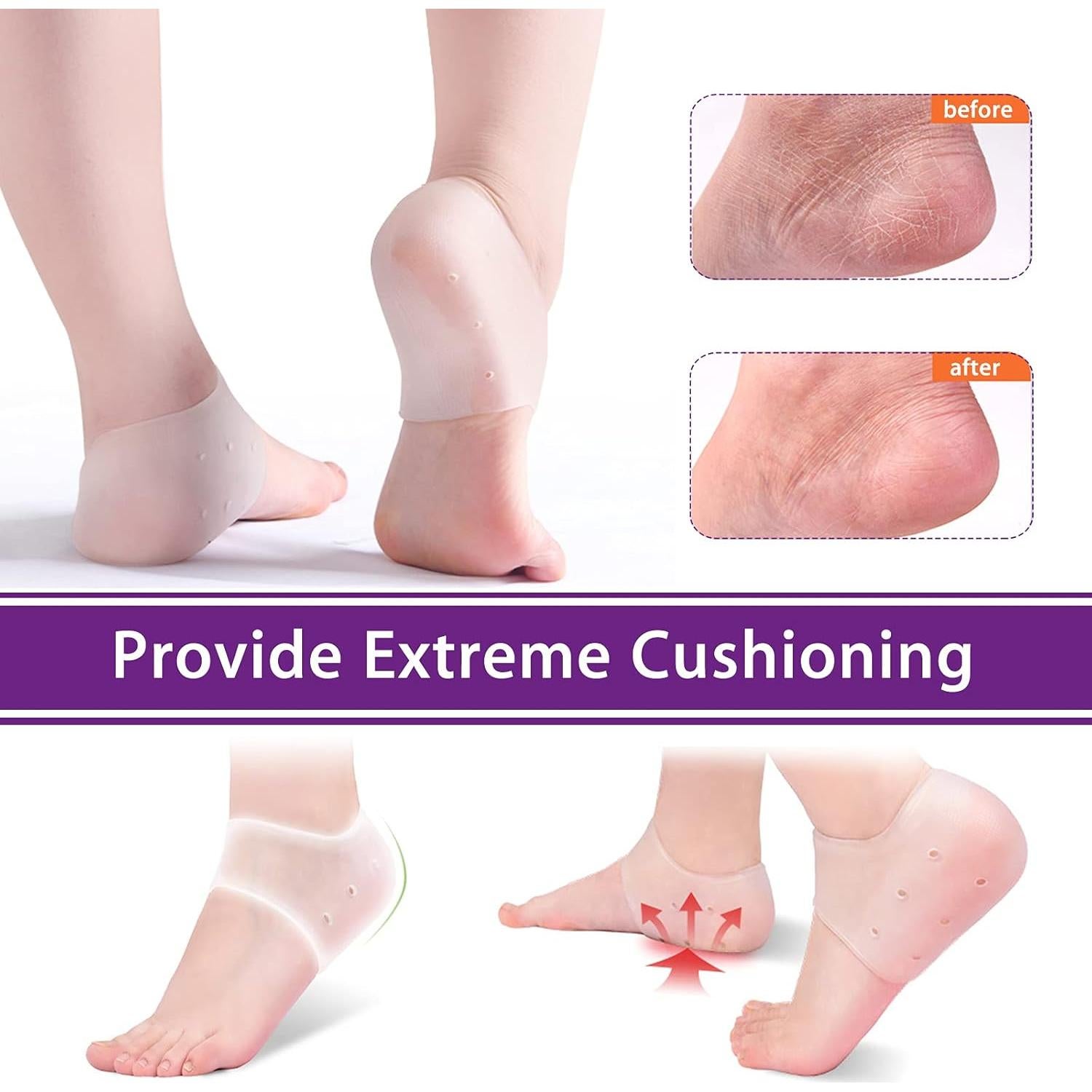 Protectores de Talón de Gel RooRuns - 2 Pares Almohadillas