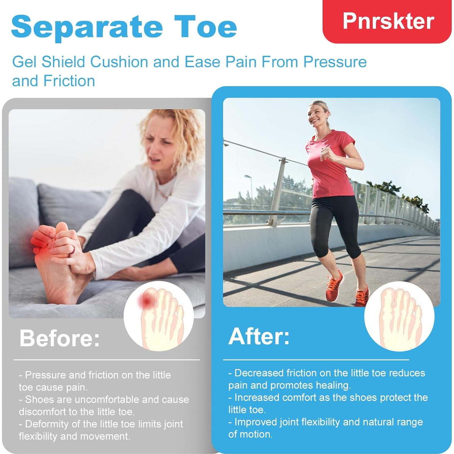 Protectores de Dedos Pnrskter - 10 Fundas de Gel con Aloe Vera