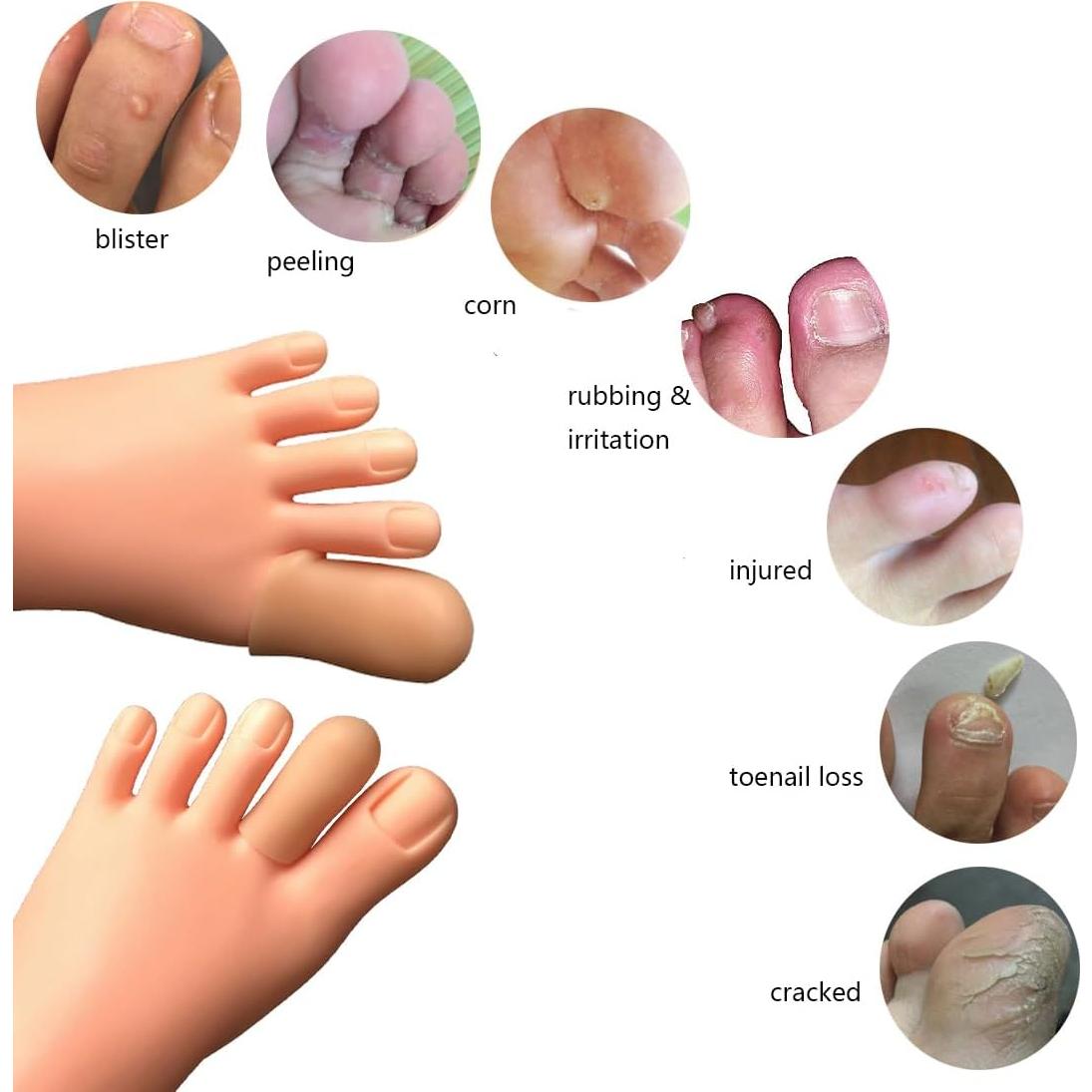 30 Protectores de Dedos Conpru de Goma SEBS - Alivio de Dolor