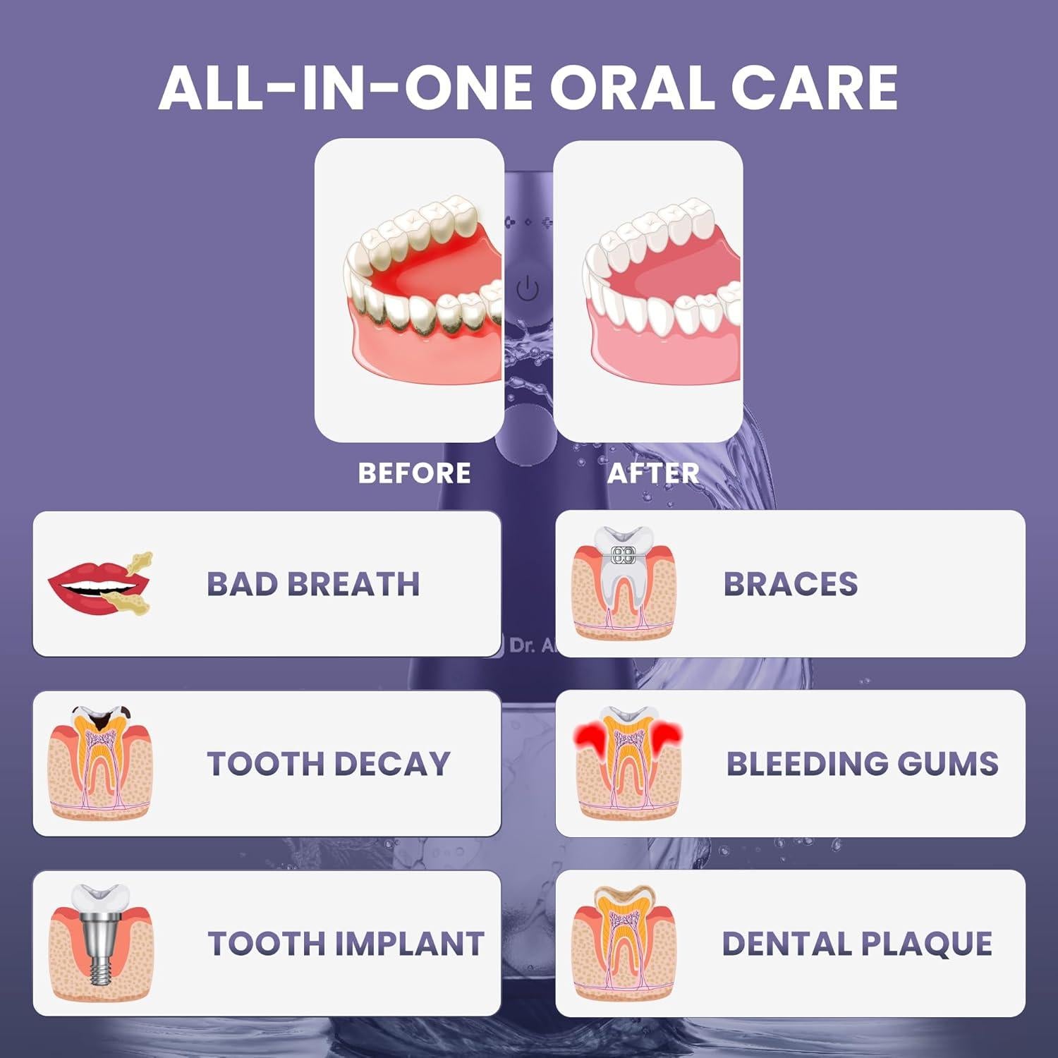 Irrigador Dental Dr. Aid Portátil Inalámbrico 311ml Negro