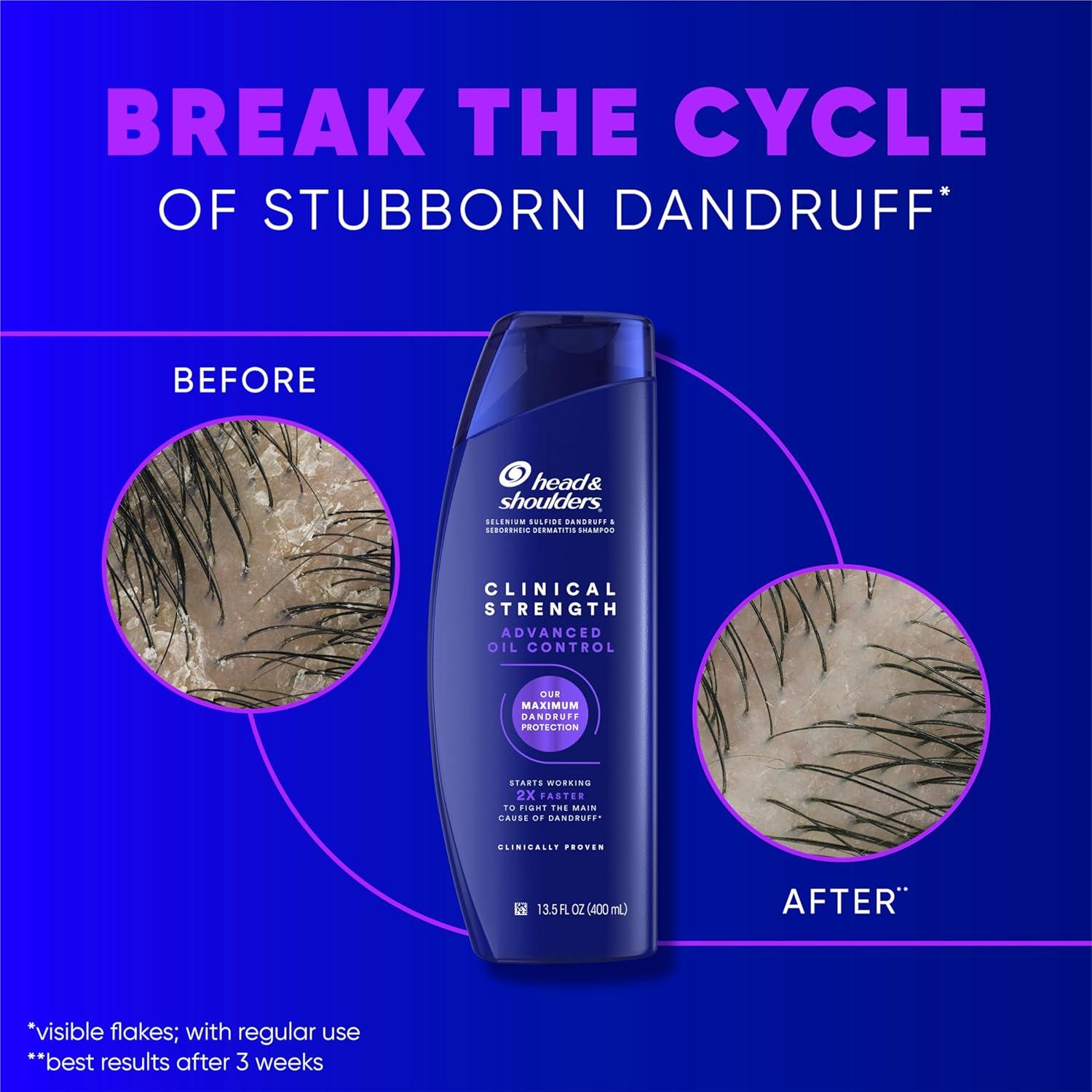 Champú Anticaspa Head & Shoulders Doble Fuerza 1L Cítrico