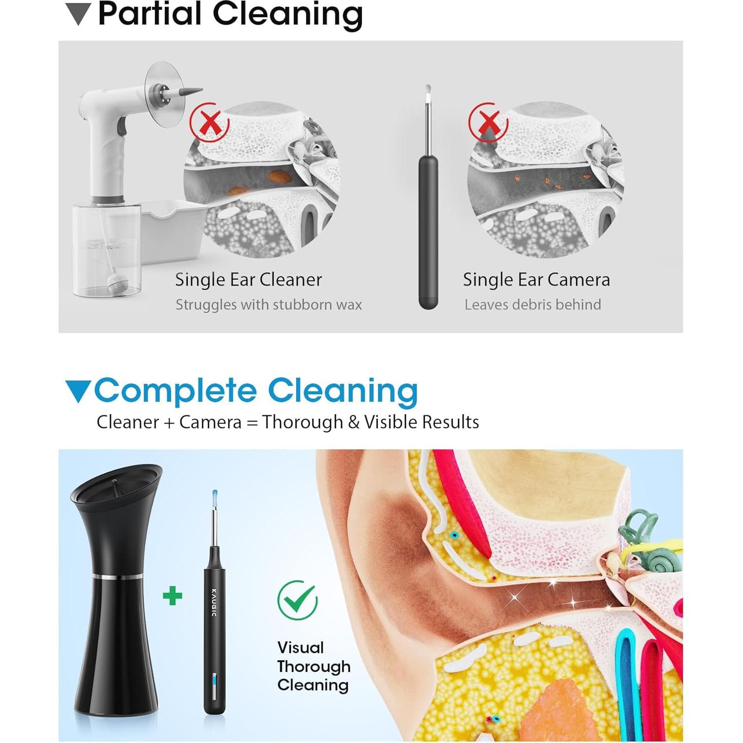 Kit de Limpieza de Oídos KAUGIC con Cámara y Irrigador