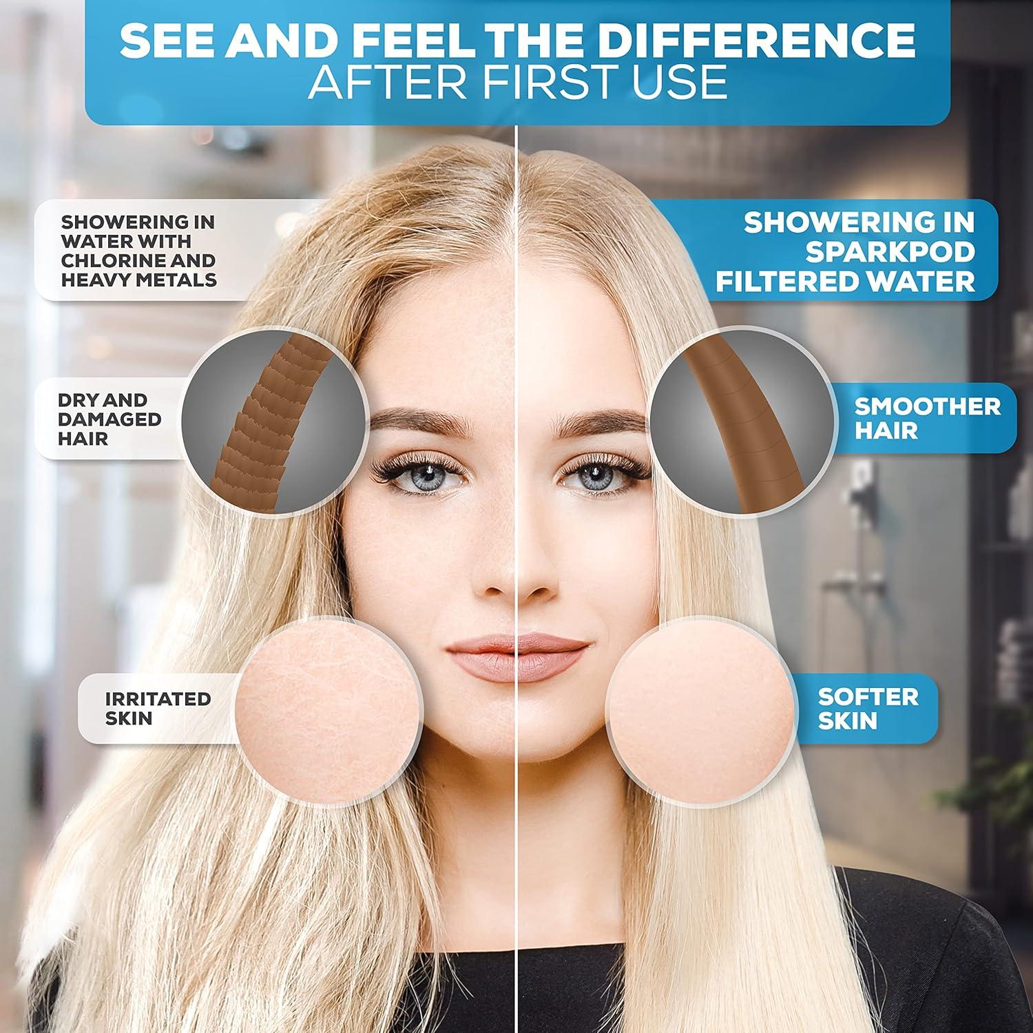 Cabezal de Ducha SparkPod 6" Alta Presión con Filtro 23 Etapas