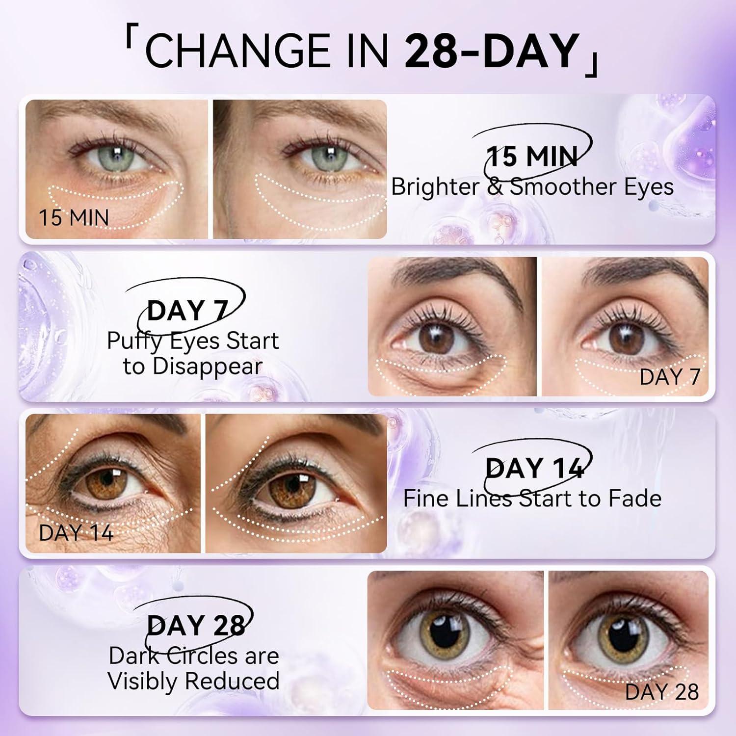 Parche de Retinol para Ojos LANBENA - 30 Pares Hidra-Gel