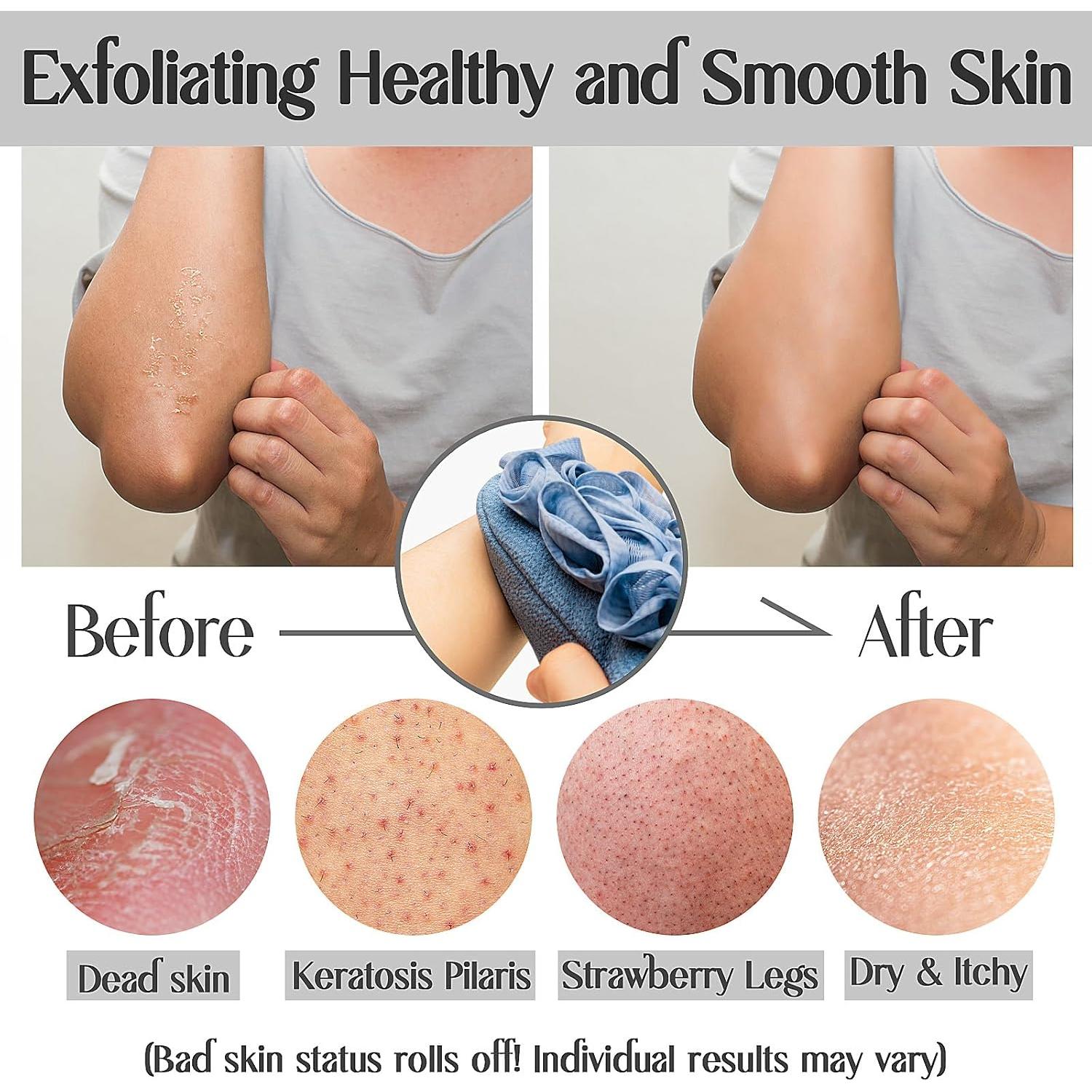 Mitones Exfoliantes Doble Cara Kullder - 2 Piezas Rosa y Azul