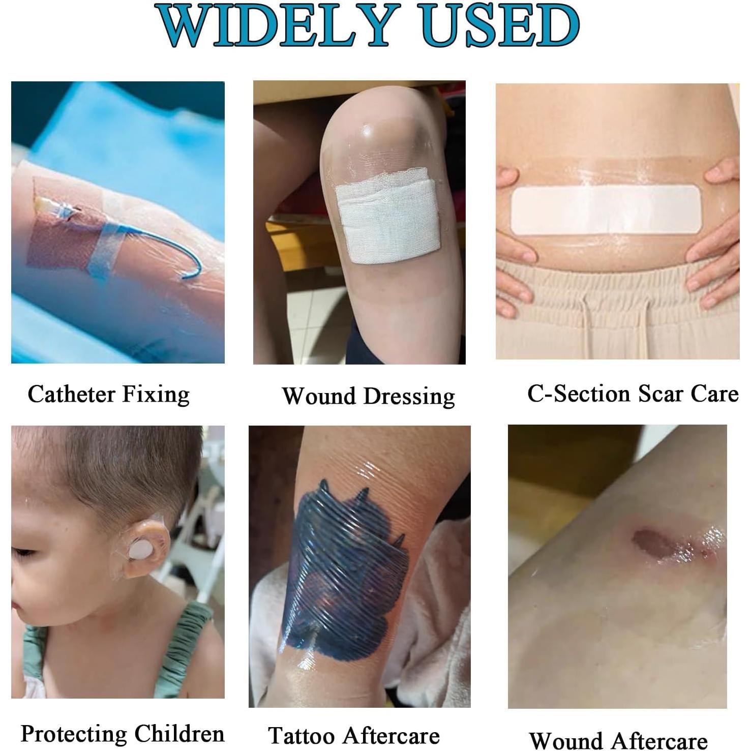 Vendaje Impermeable ANAMPION 15.24cm x 1.83m para Tatuajes