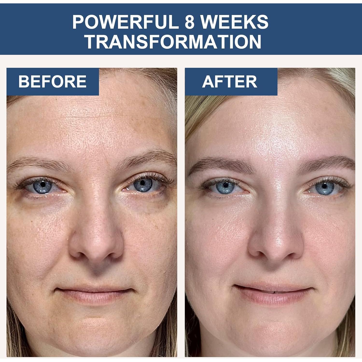 Mascarilla Facial de Colágeno AVJONE Hidratante 4 Piezas