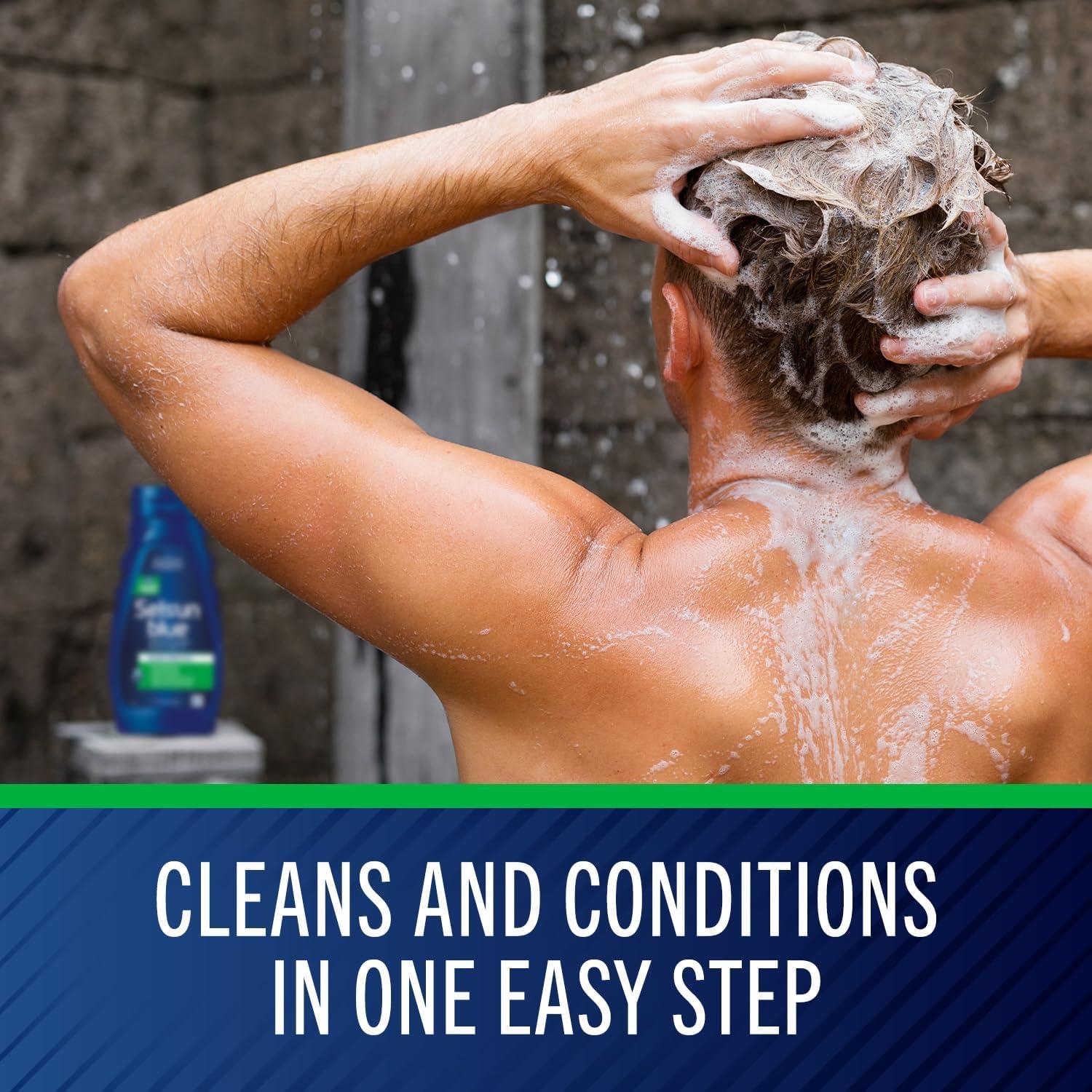 Champú Anticaspa Hidratante Selsun Blue 325 ml, 1% Sulfuro Selenio