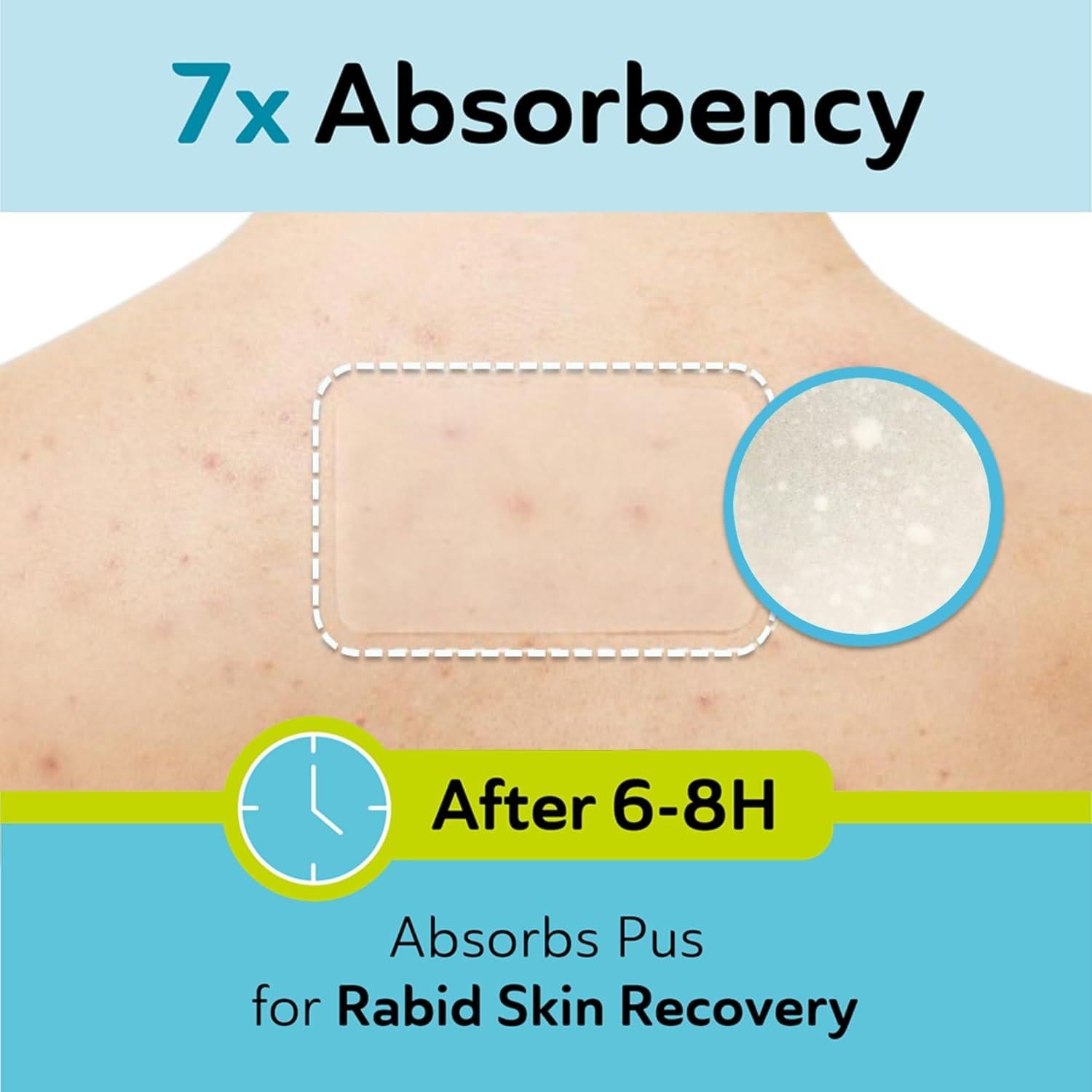 Parche Hidrocoloide Grande para Granos BenQ - 10 Puntos