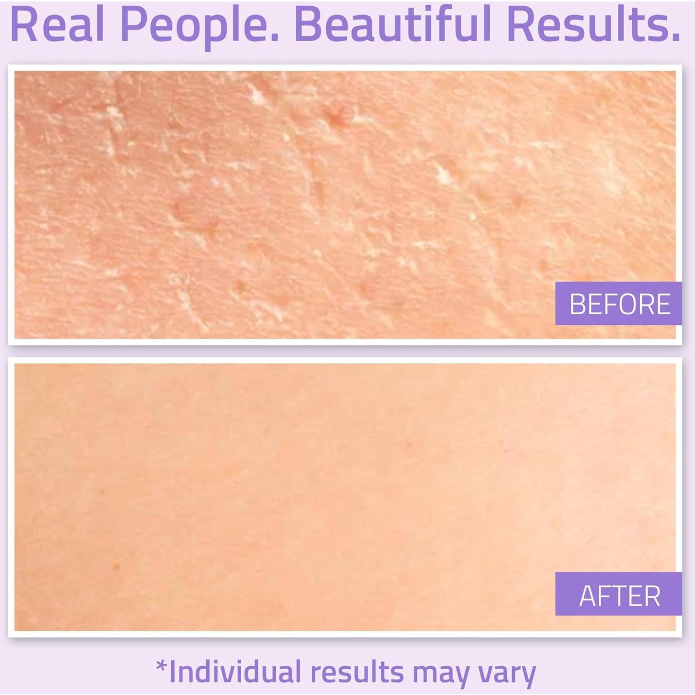 Crema Hidratante Facial YEOUTH Ácido Hialurónico 28.35g