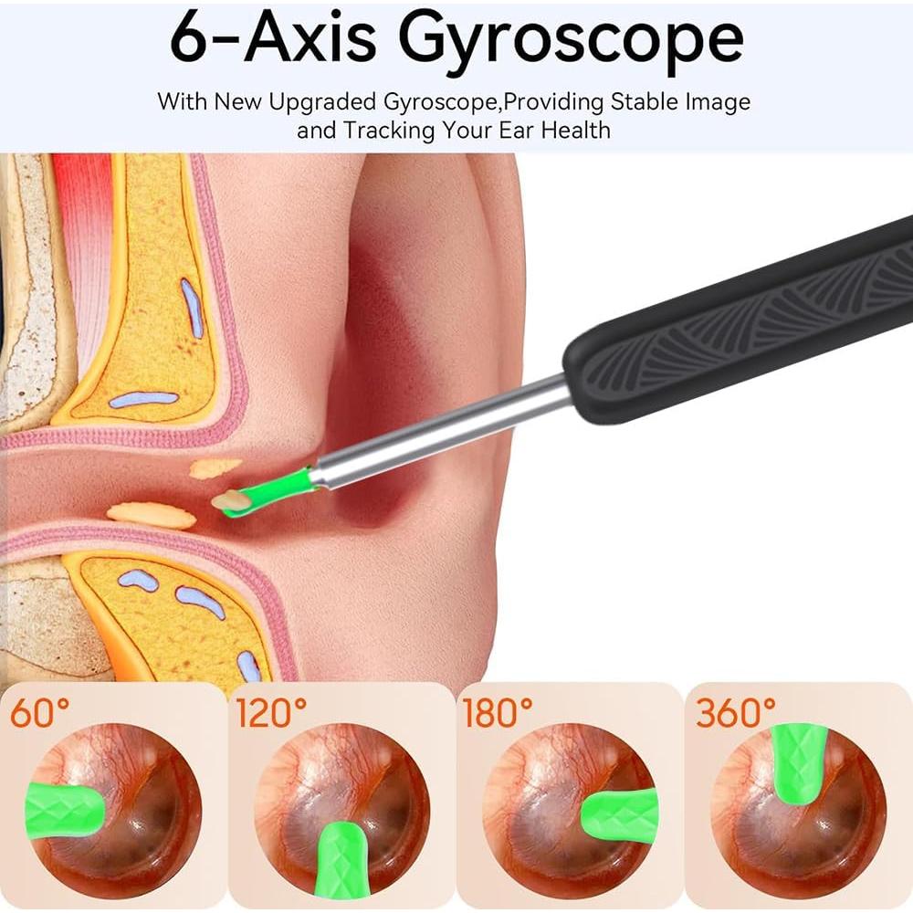 Kit de Limpieza de Oídos CZYJPRL con Cámara 1080P y 8 Piezas