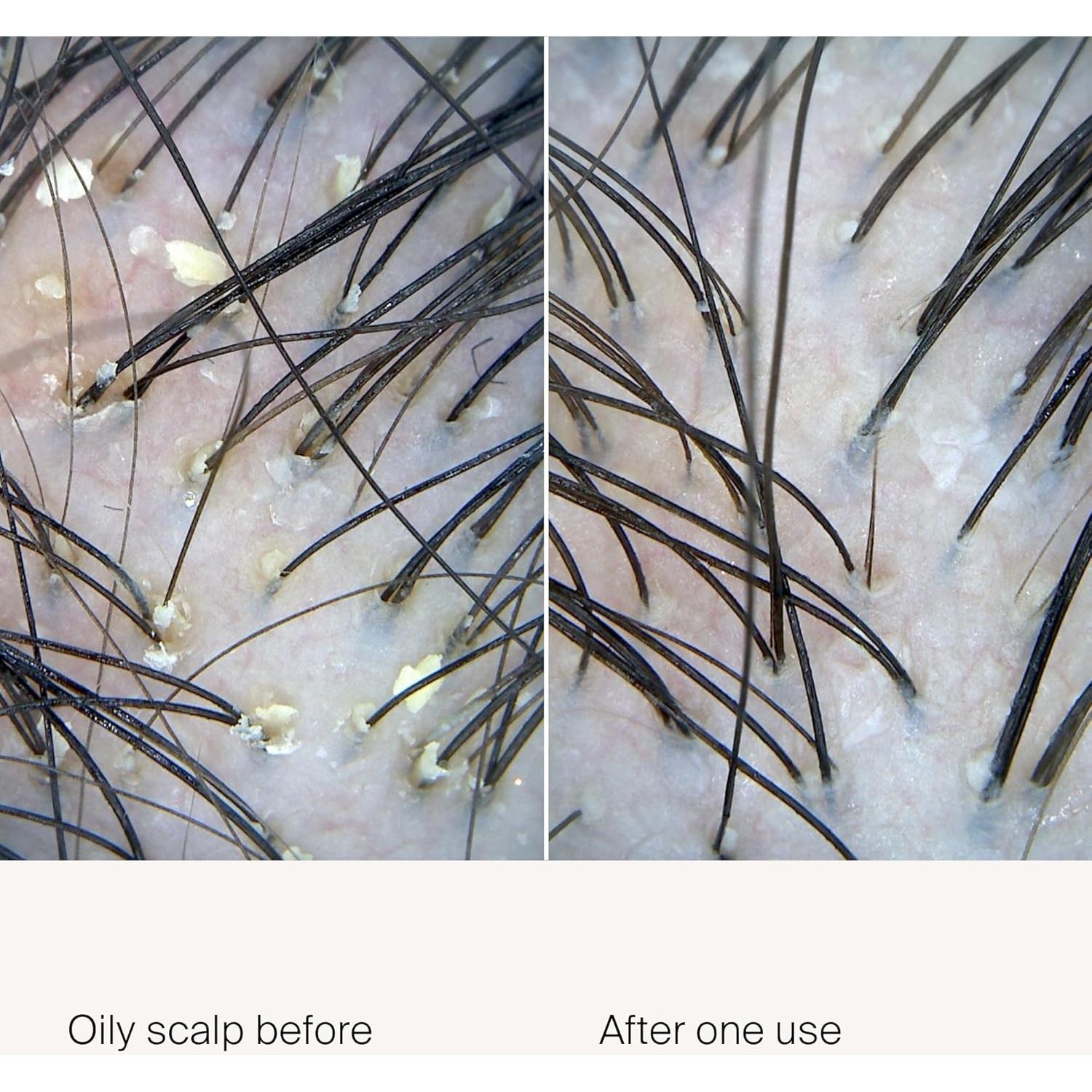 Exfoliante para Cuero Cabelludo Living Proof 100 ml