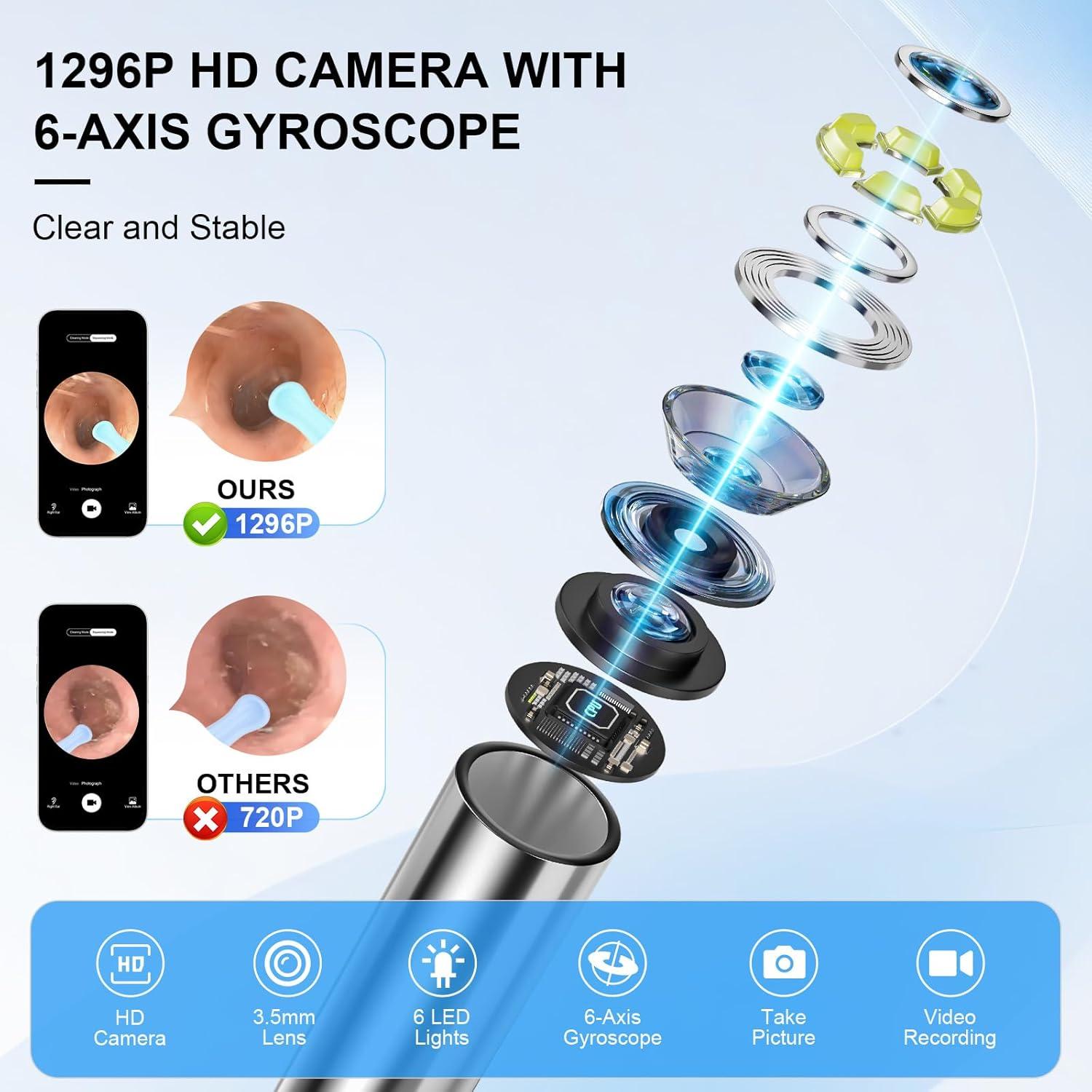 Kit Limpiador de Oídos Inalámbrico Keyloland con Cámara HD