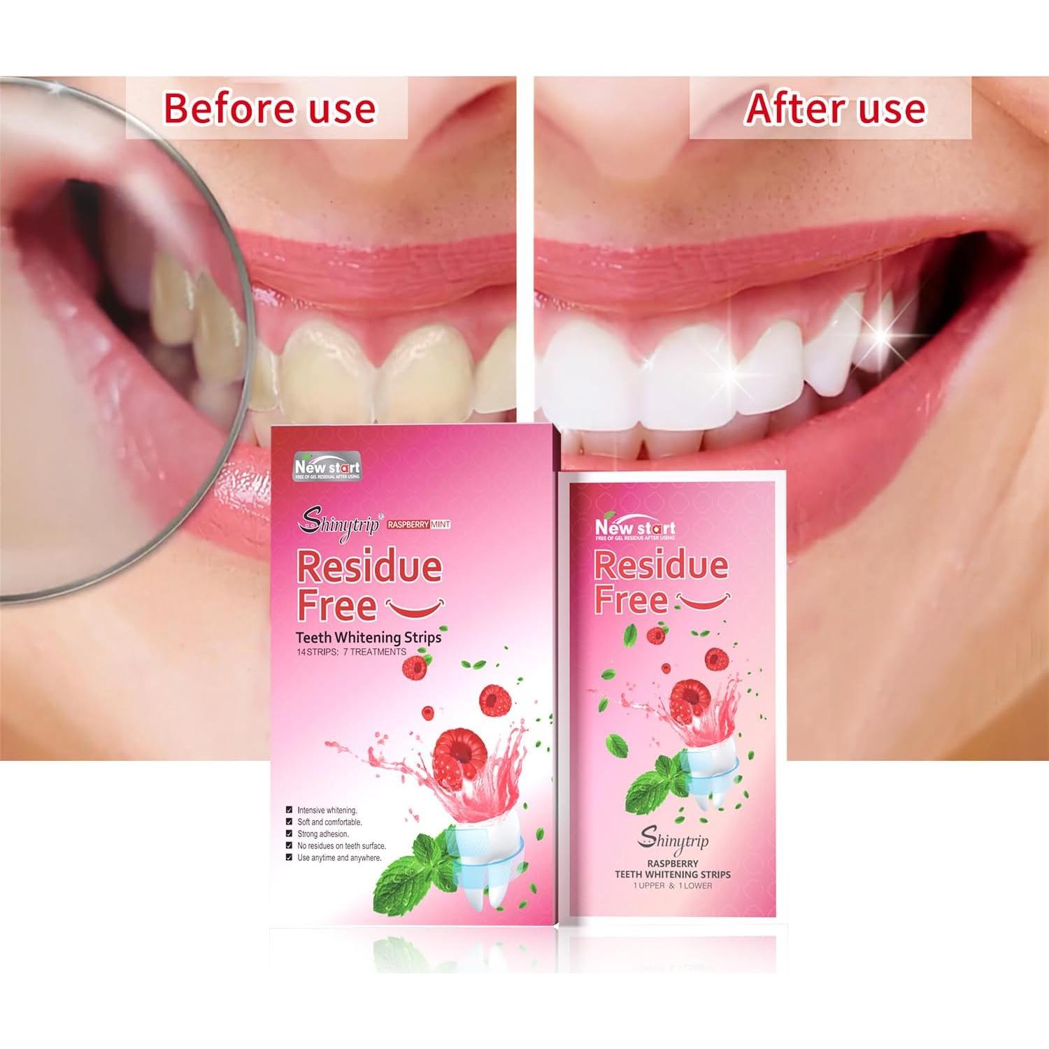 Tiras Blanqueadoras para Dientes Sensibles BOTARE - 14 Tiras