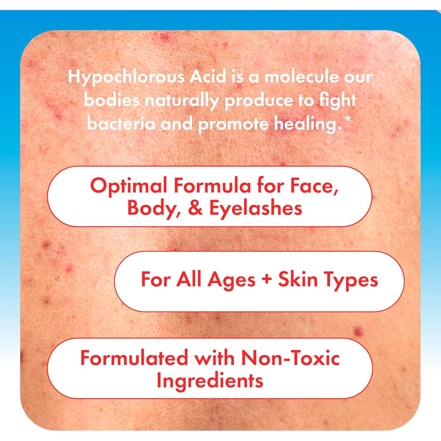 Spray de Ácido Hipocloroso HypoClear 236.6 ml - Limpiador Facial Suave