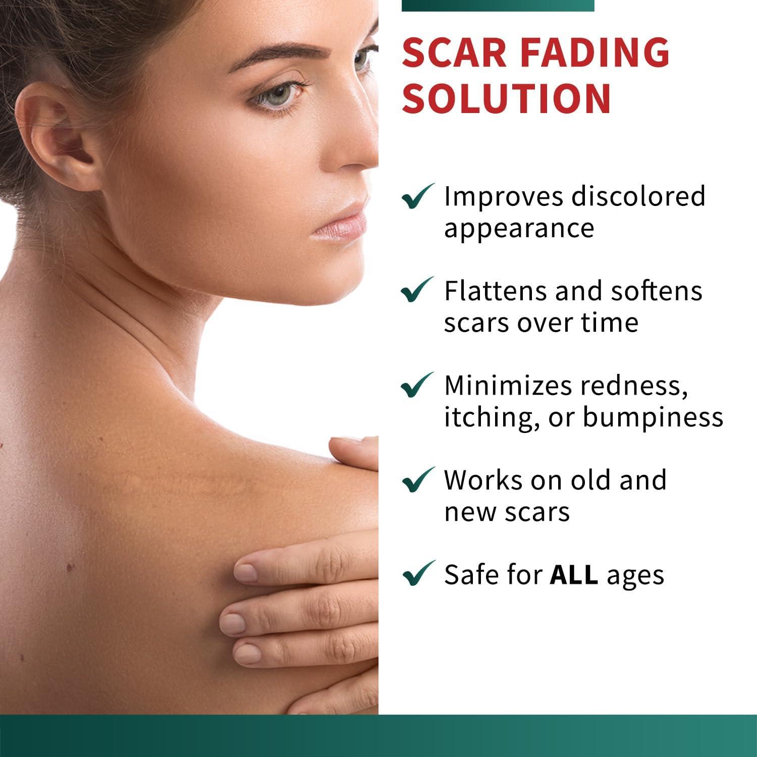 Cinta de Cicatriz de Silicona Protect Life 4.06 cm x 299.72 cm