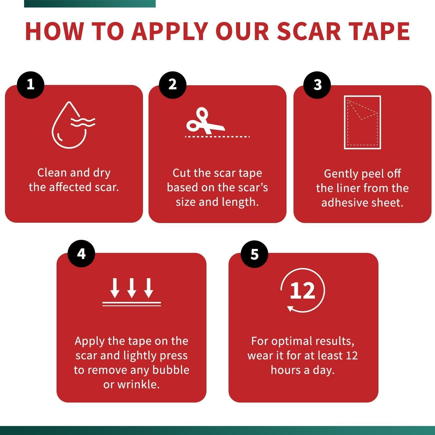 Cinta de Cicatriz de Silicona Protect Life 4.06 cm x 299.72 cm