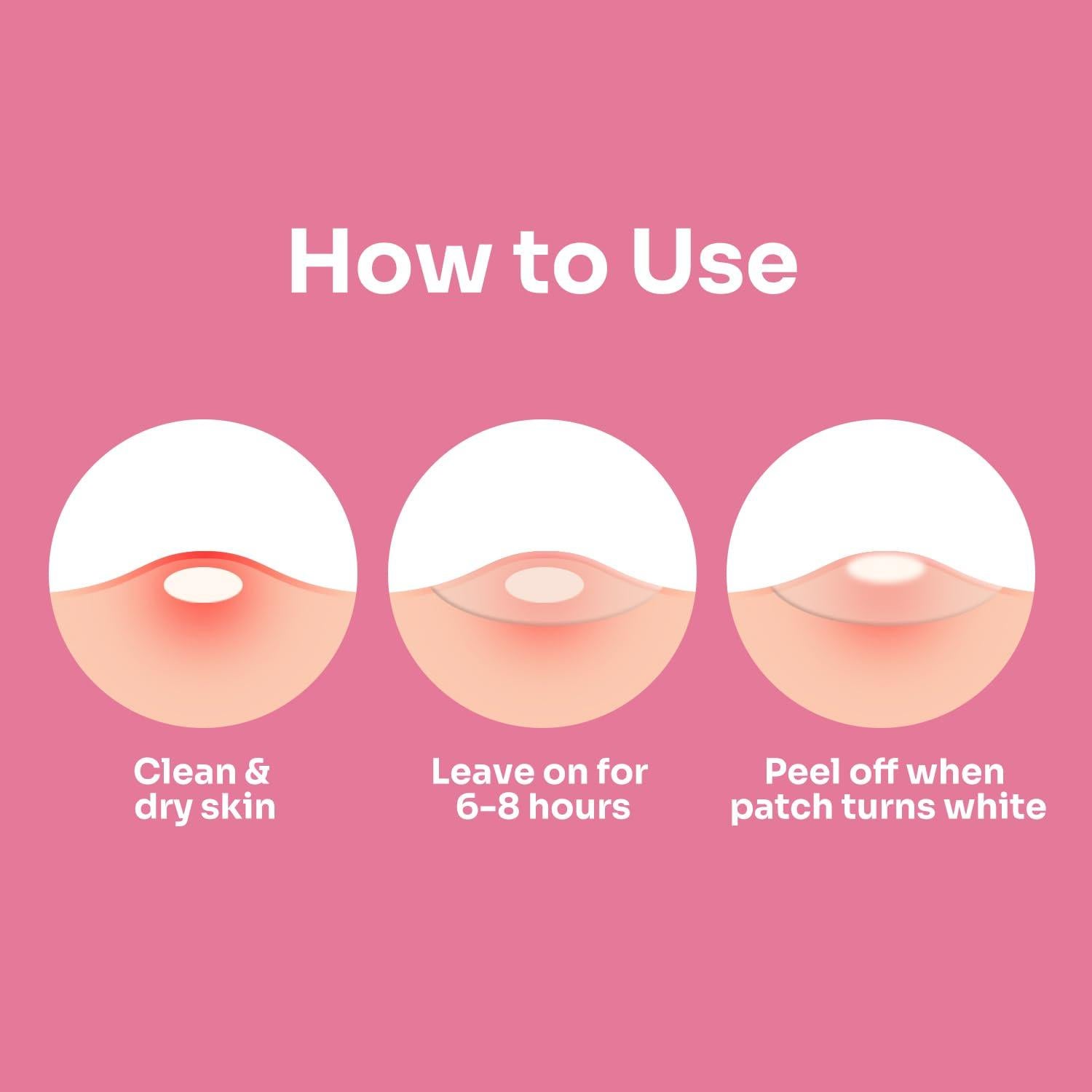 Parche de Acné Hidrocoloide Conkote Grande - 5 Unidades