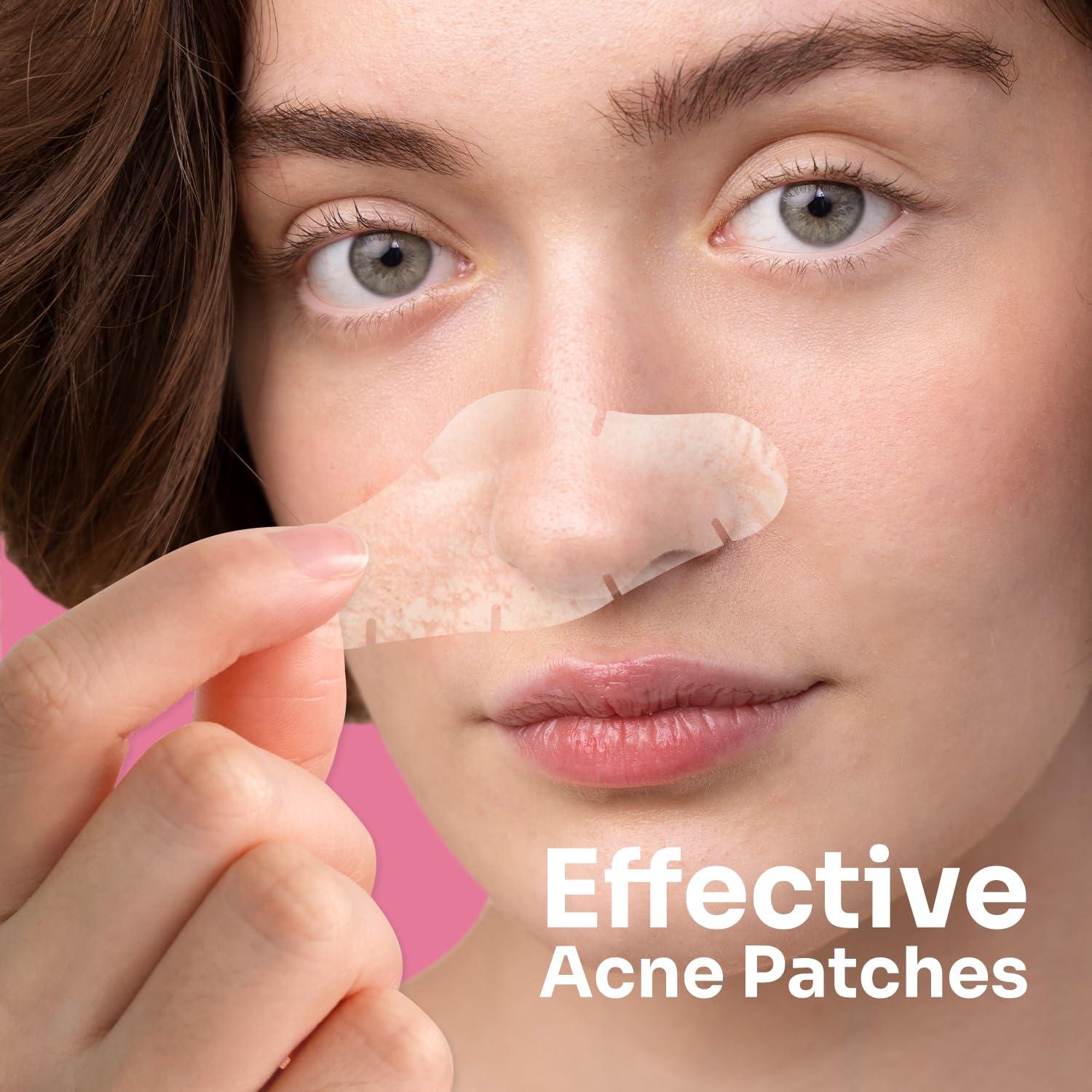 Parche de Acné Hidrocoloide Conkote Grande - 5 Unidades