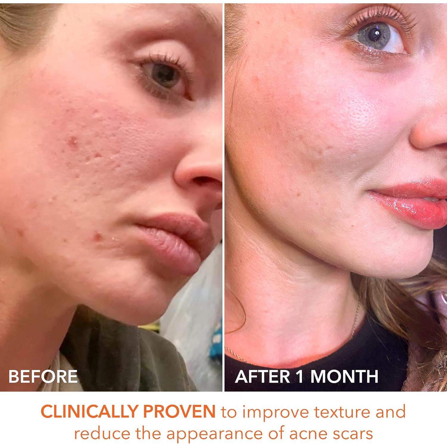 Peeling Diario Dr. Dennis Gross 5 Tratamientos Anti-Aging