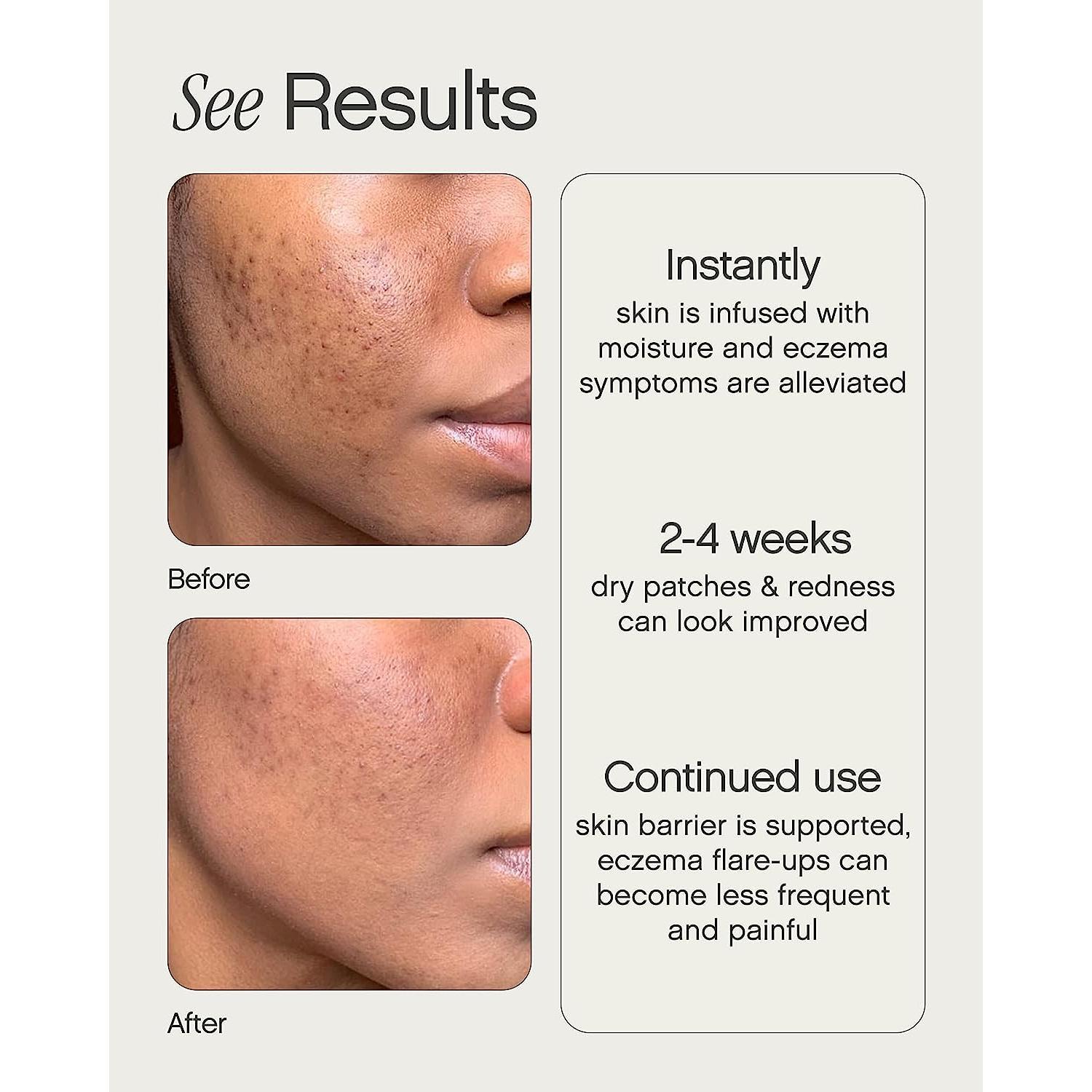 Hidratante Like Butter Topicals 50 ml para piel seca y eczema