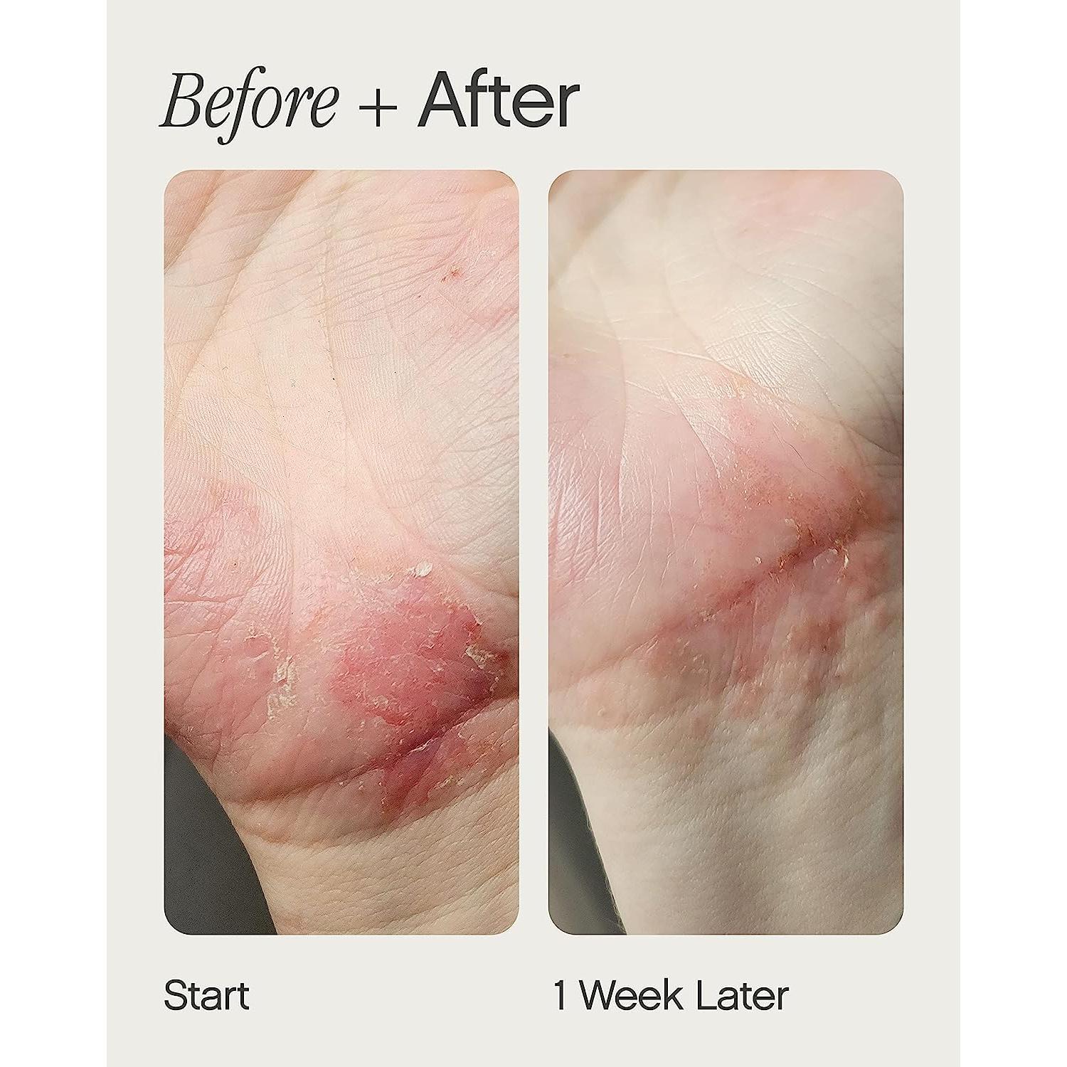 Hidratante Like Butter Topicals 50 ml para piel seca y eczema