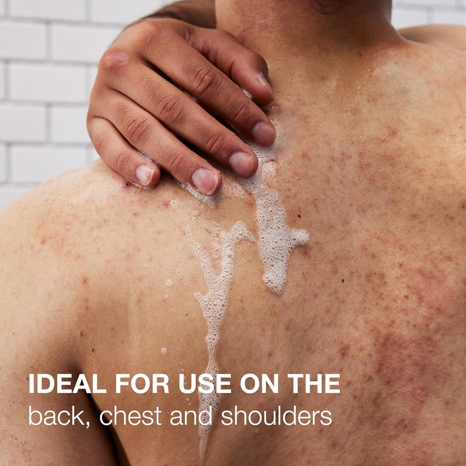 Jabón Corporal Neutrogena 250 ml con Ácido Salicílico y PHA