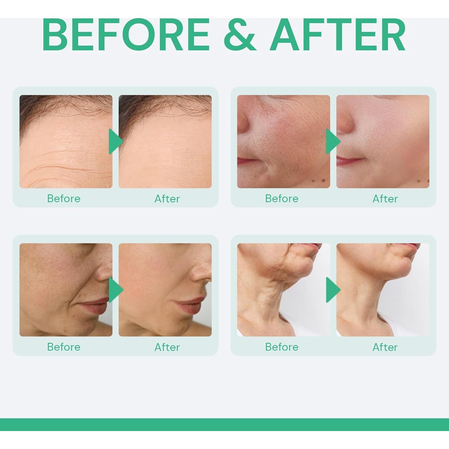 Crema de Retinol Enaskin Naturals 49 ml Hidratante Antiarrugas