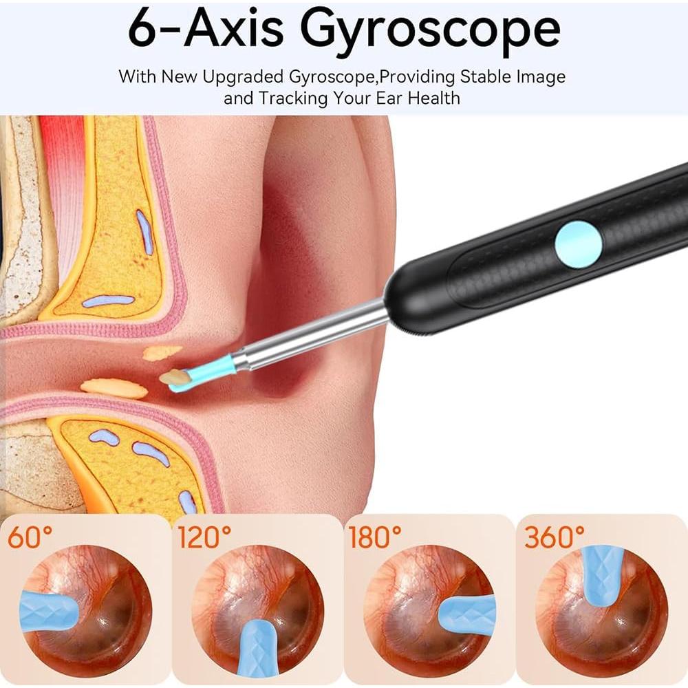 Kit de Limpieza de Oídos CZYJPRL con Cámara 1080P y 8 Cucharas