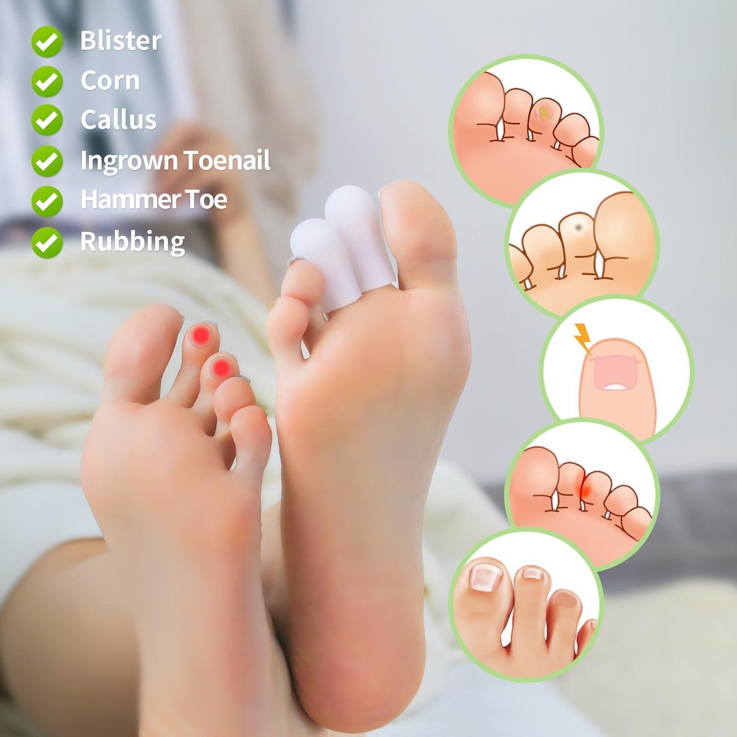 Protectores de Dedos de Silicona Niupiour - 14 Paquetes Medianos