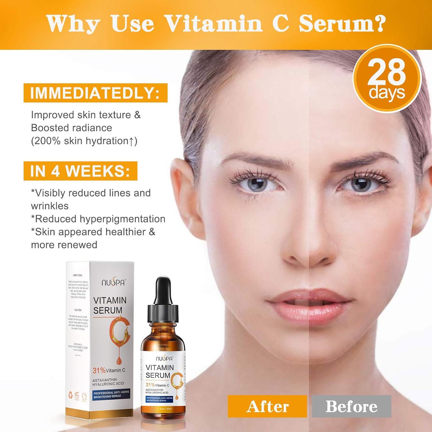 Suero Facial Nuspa Vitamina C 31% 30 ml Antienvejecimiento