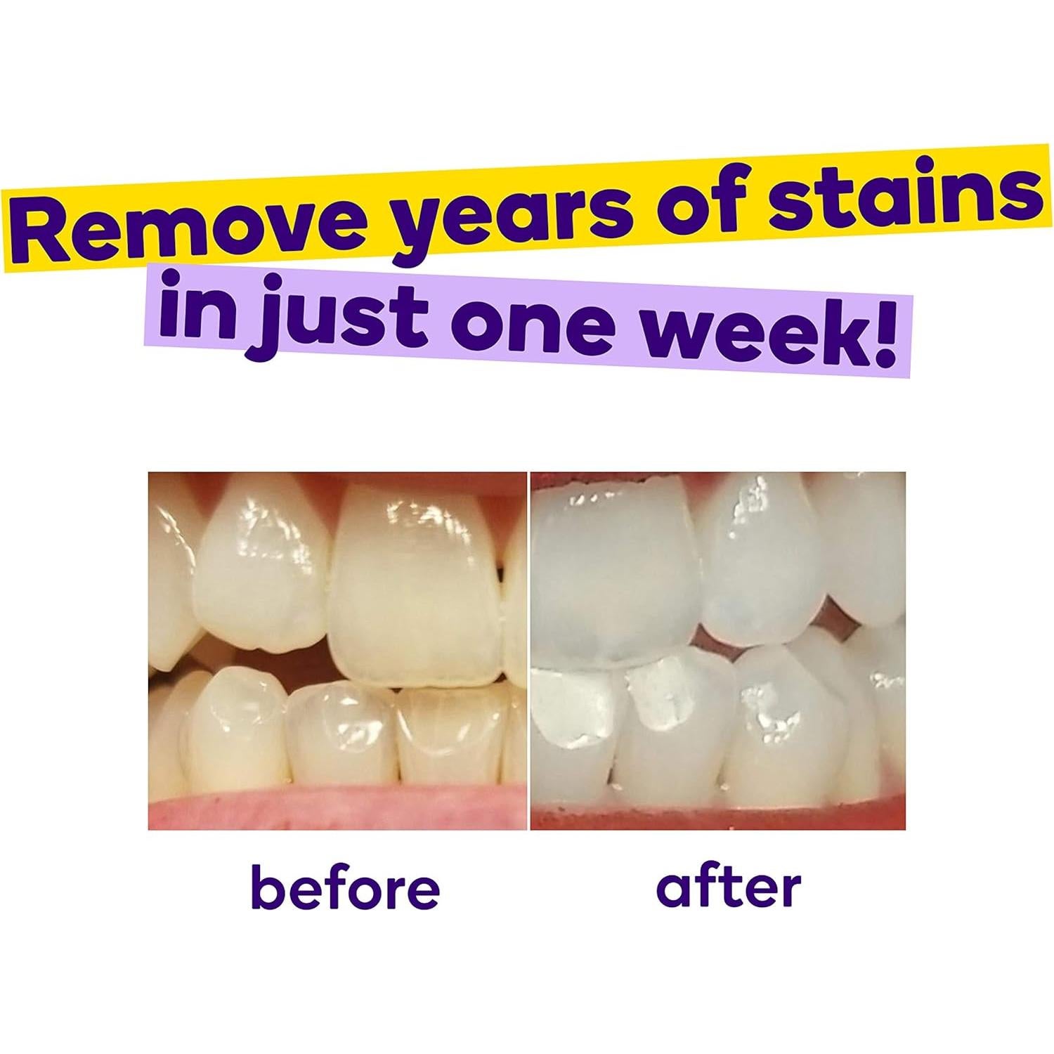 Tiras Blanqueadoras BURST con Aceite de Coco - 7 Tratamientos