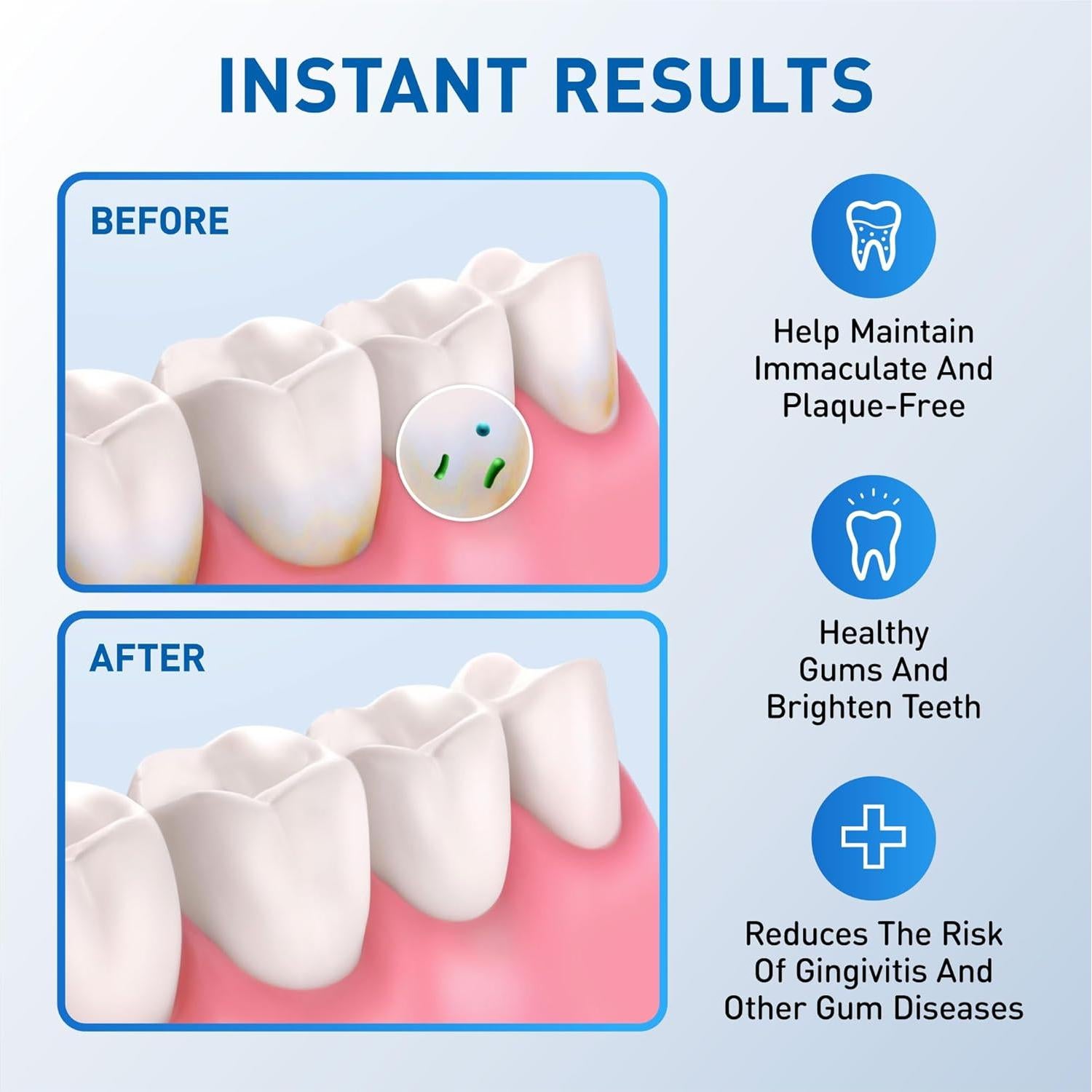 Cabezas de Reemplazo para Flosser de Agua Waterpik - 6 Consejos Clásicos