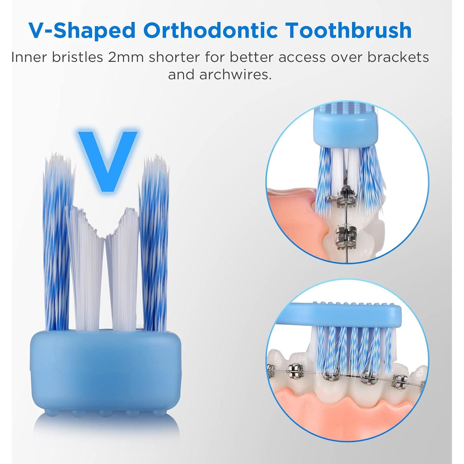 Cepillo de Dientes Ortodóntico Fremouth en Forma de V - 6 Unidades