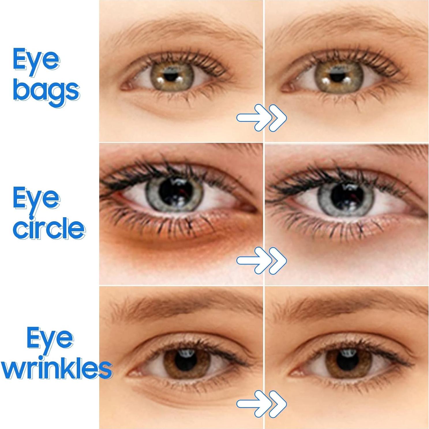 Parche para Ojos Ruzzut - 28 Pares Gel Colágeno Hidratante