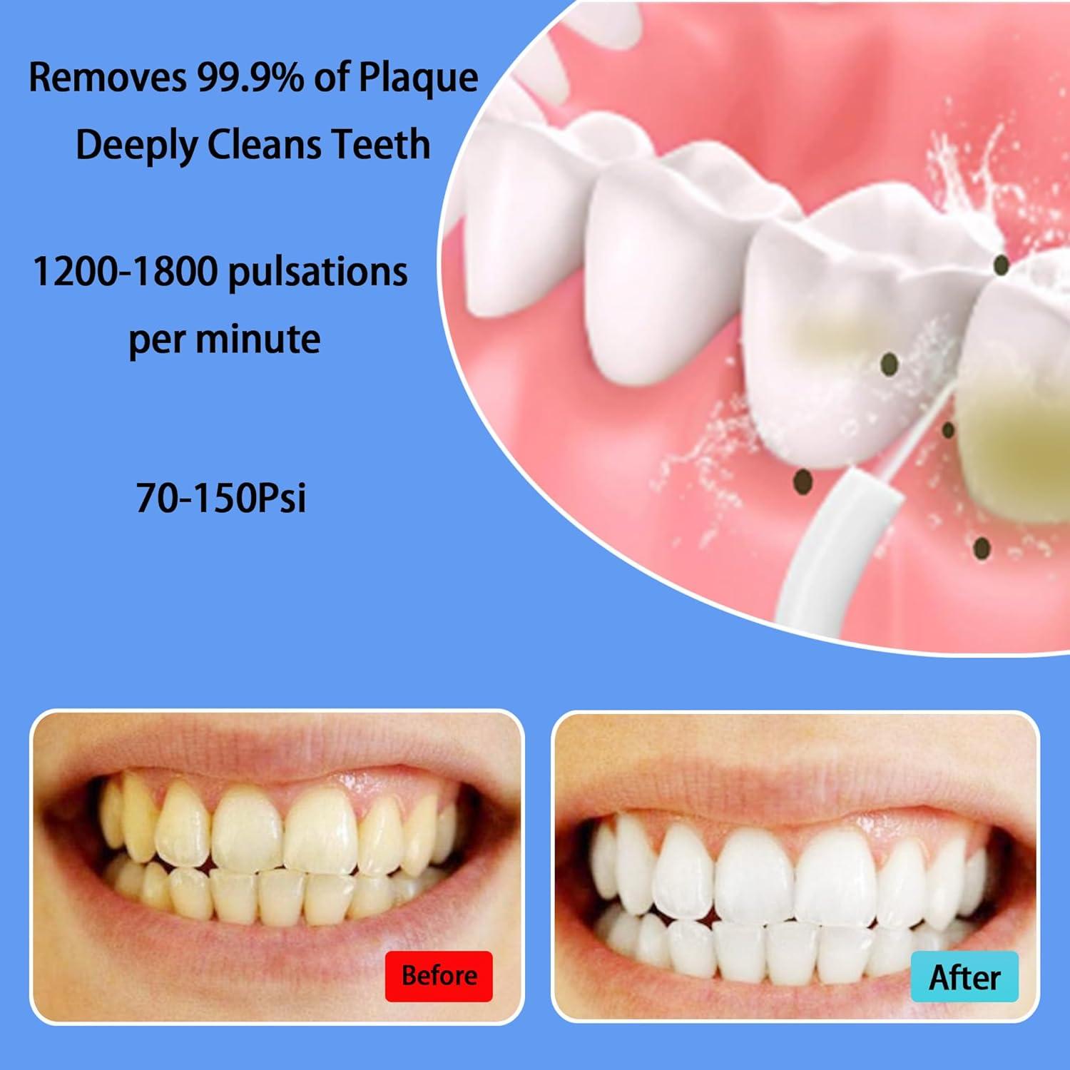 Irrigador Oral Portátil Boicafe YMXXYQ Negro 3 Modos 4 Puntas