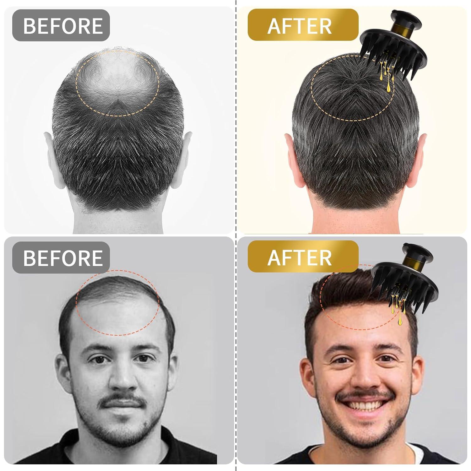 Cepillo Aplicador de Aceite TOCULAB para Crecimiento del Cabello