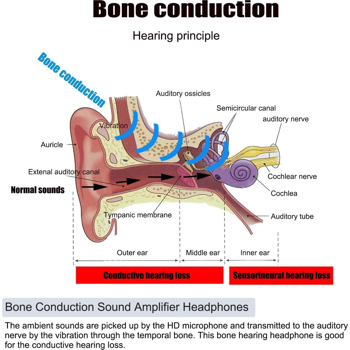 Auriculares Bluetooth Beisidi SoneHearing S1 Conducción Ósea 15H
