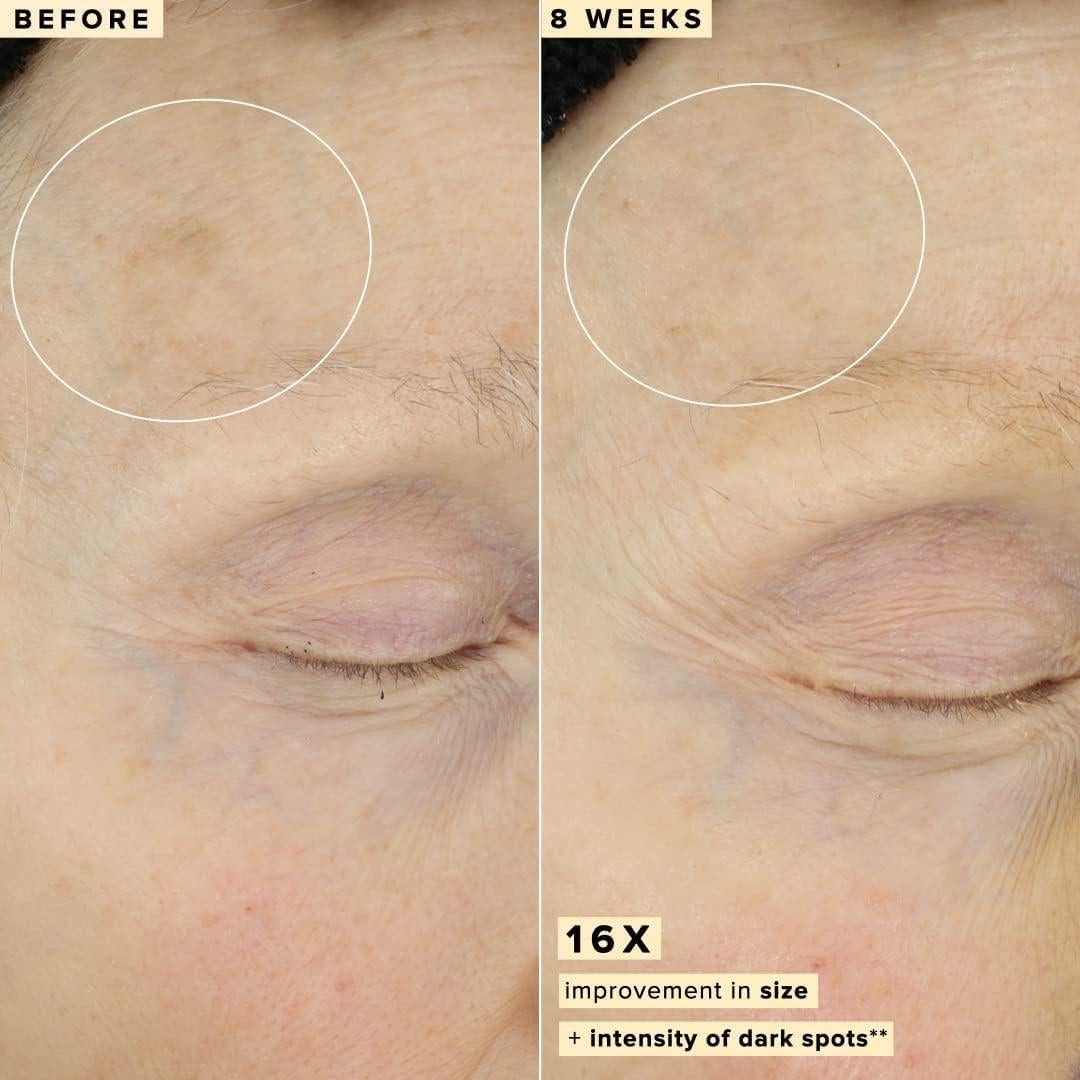 Suero Facial Vitamina C 10% Farmacia 5ml - Ilumina y Suaviza