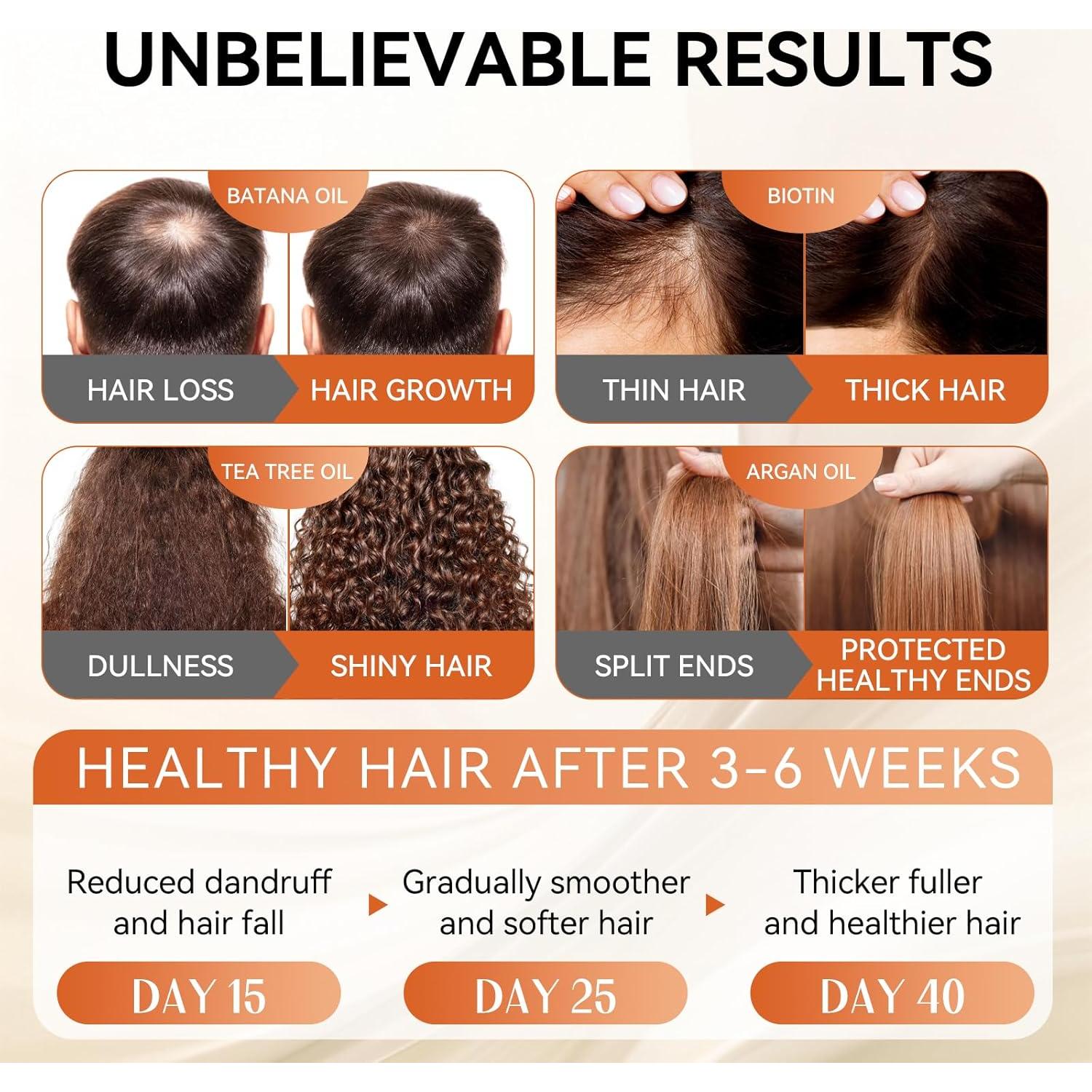 Juego de Champú y Acondicionador LABJD Aceite de Ricino 500ml