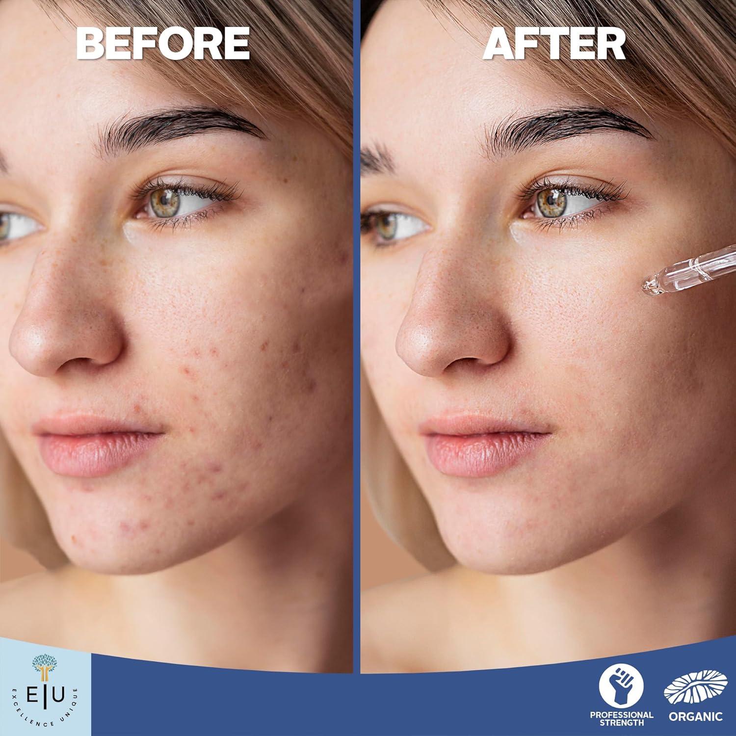 Suero de Ácido Hialurónico Orgánico E U Excellence 30ml