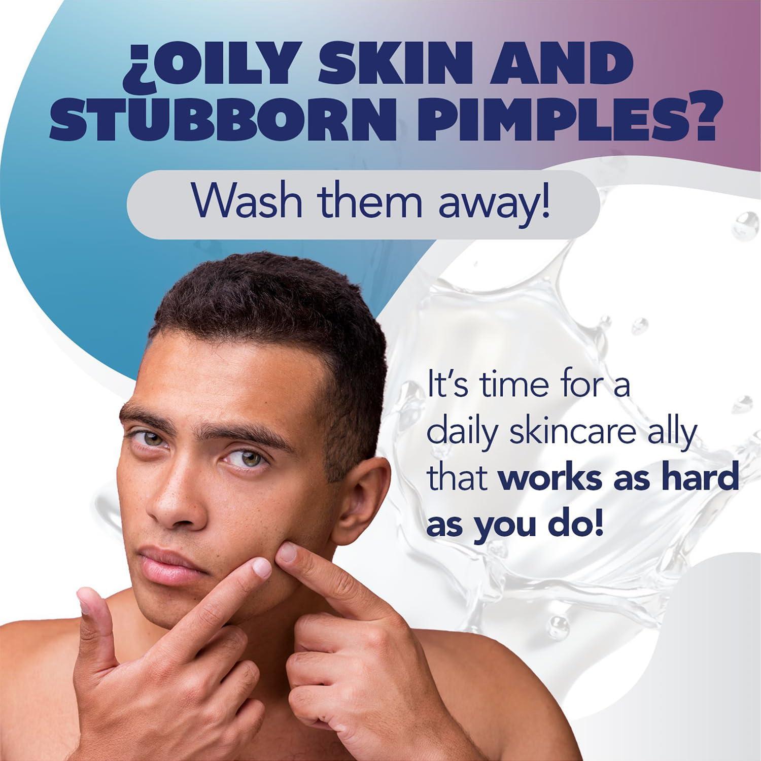 Jabón en Barra Asepxia Tratamiento Acné 113 g 5 Unidades