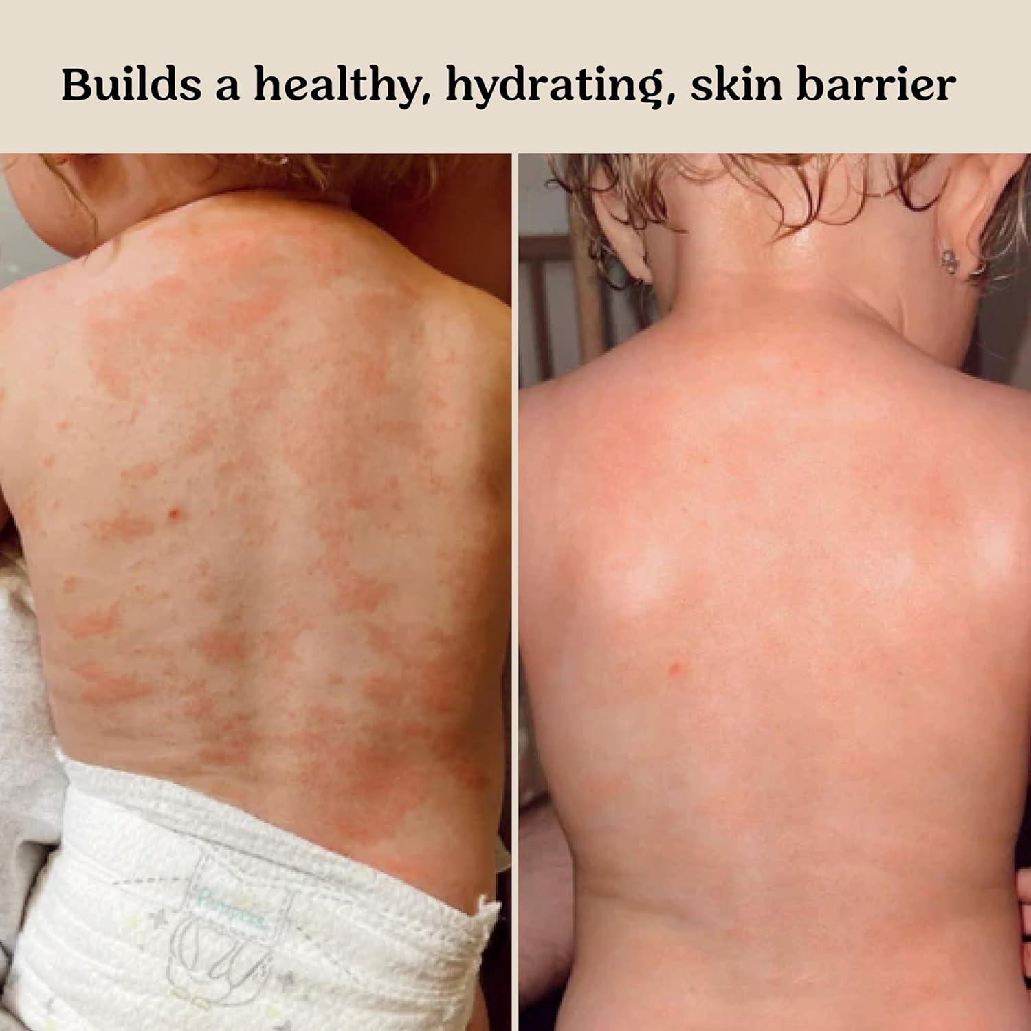 Crema Barrera para Bebés Roe Wellness 230g Hidratante Probiotica