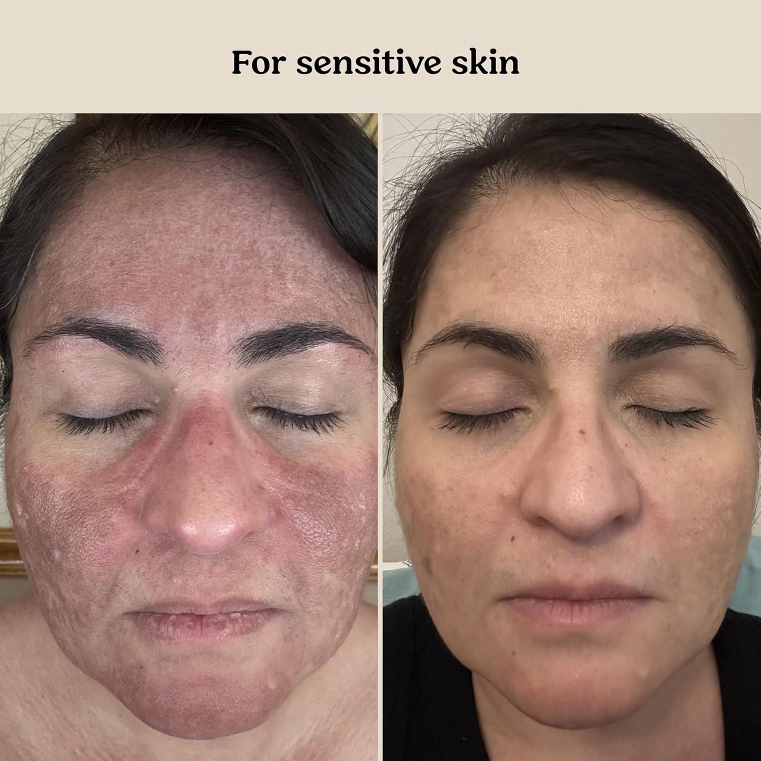 Crema Barrera para Bebés Roe Wellness 230g Hidratante Probiotica