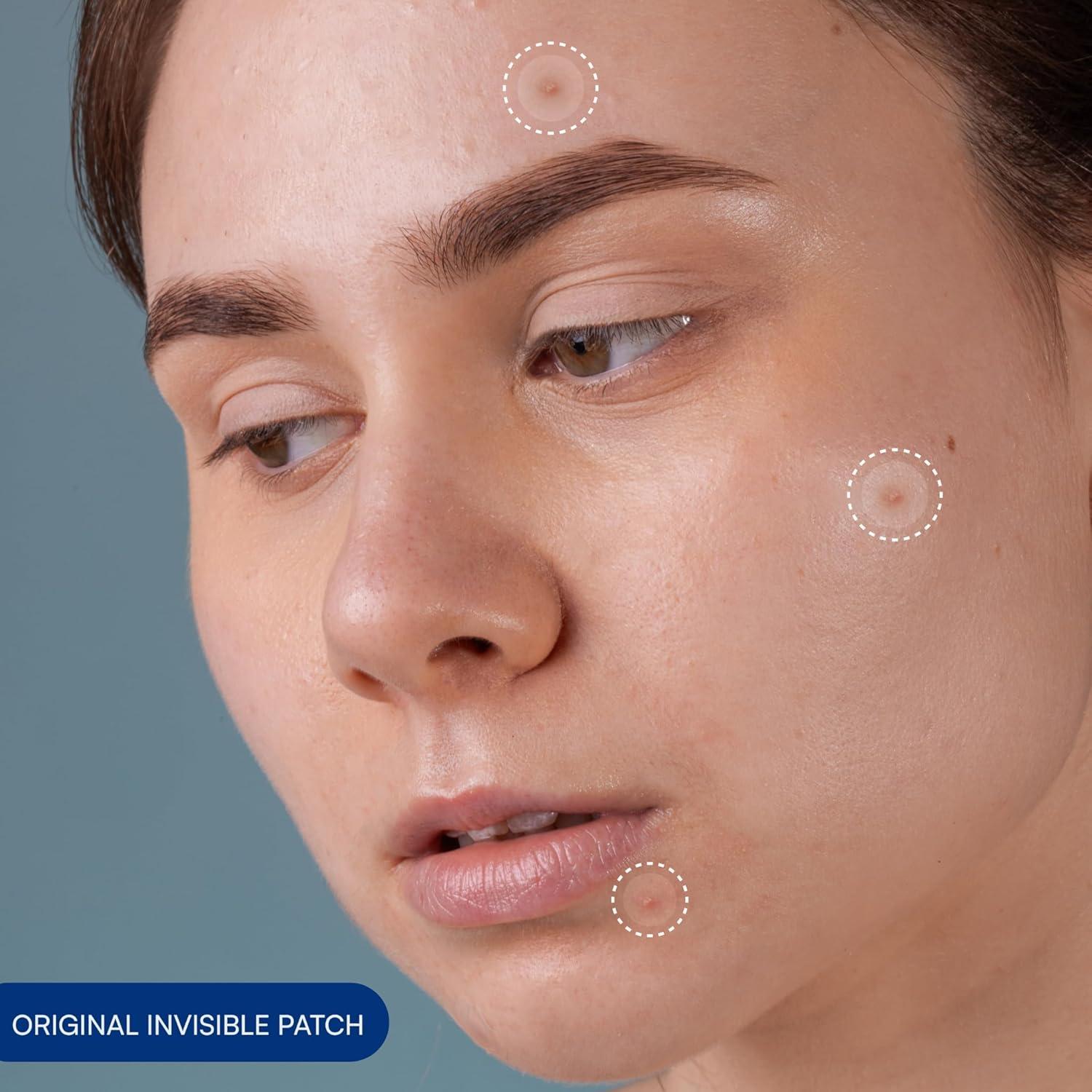 Parche Hidrocoloide Chel's Cosmetic para Acné - 66 Unidades