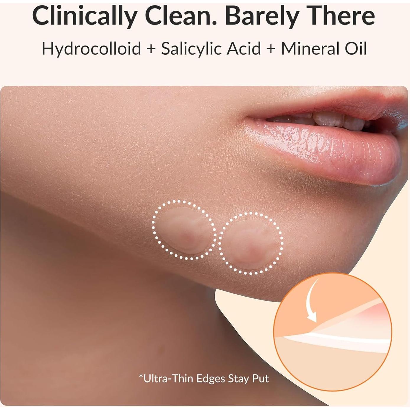 Parche Hidrocoloide RPE Life para Granos - 36 Unidades