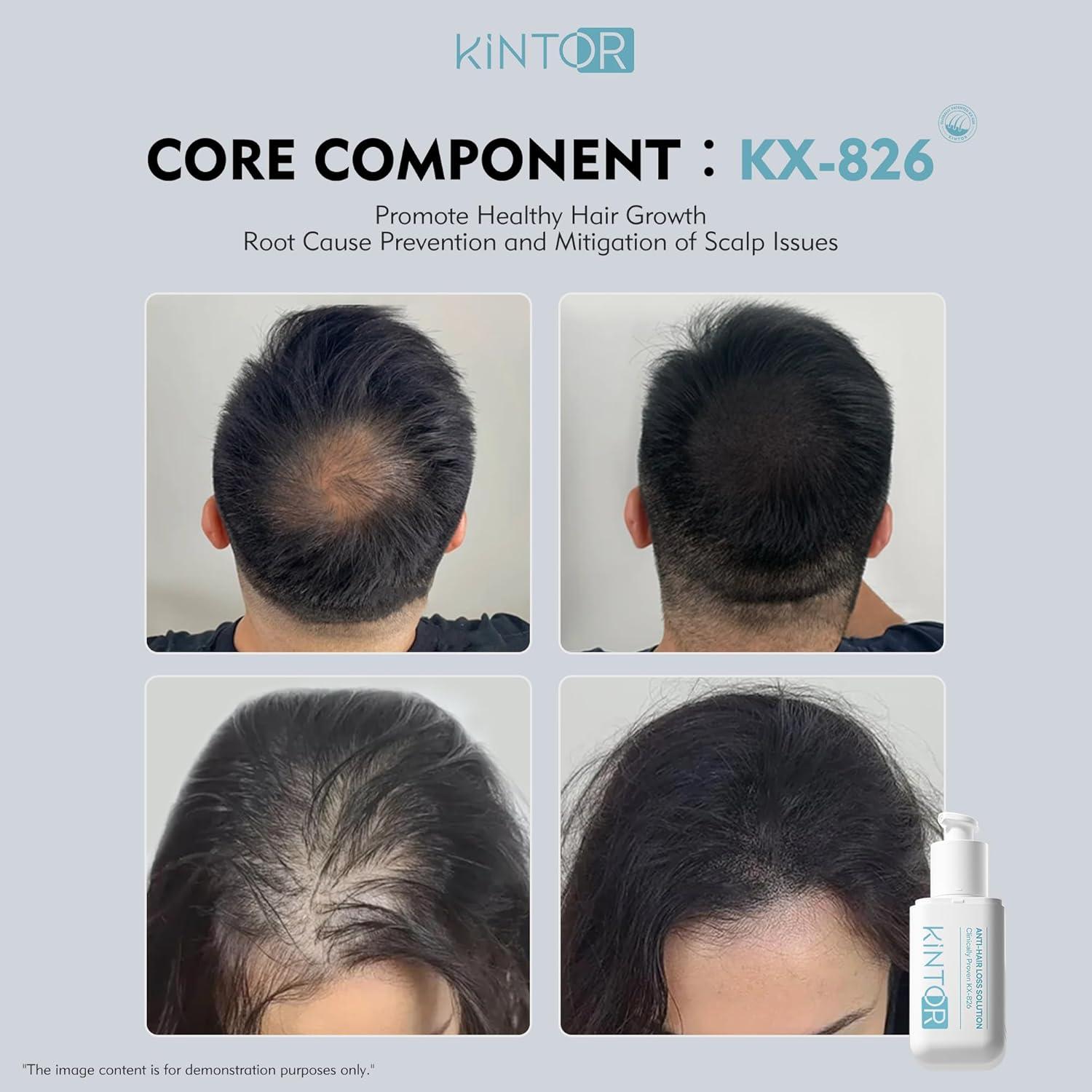 Kintor Spray Crecimiento Cabello 60ml - Bloqueador DHT 0.5%