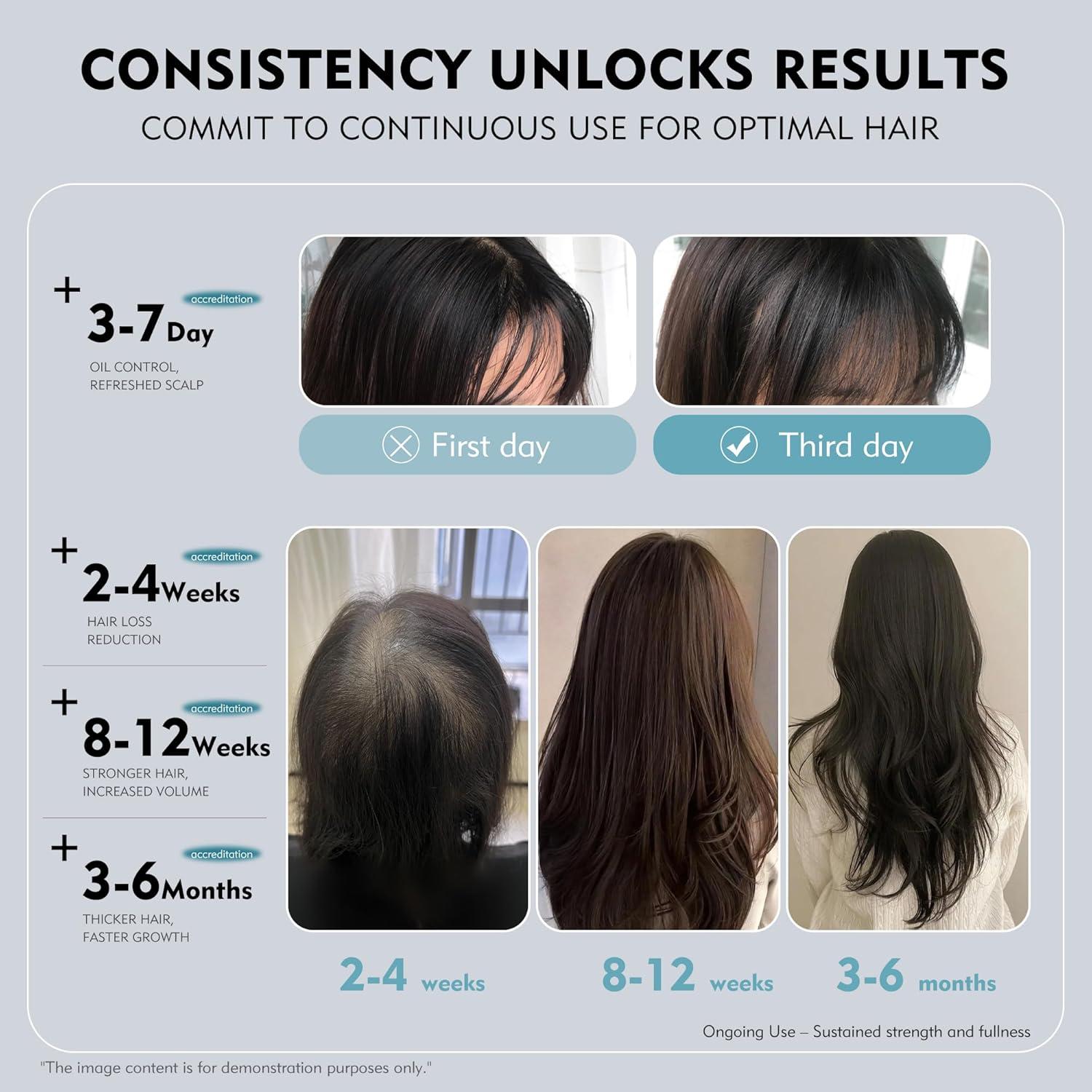 Kintor Spray Crecimiento Cabello 60ml - Bloqueador DHT 0.5%