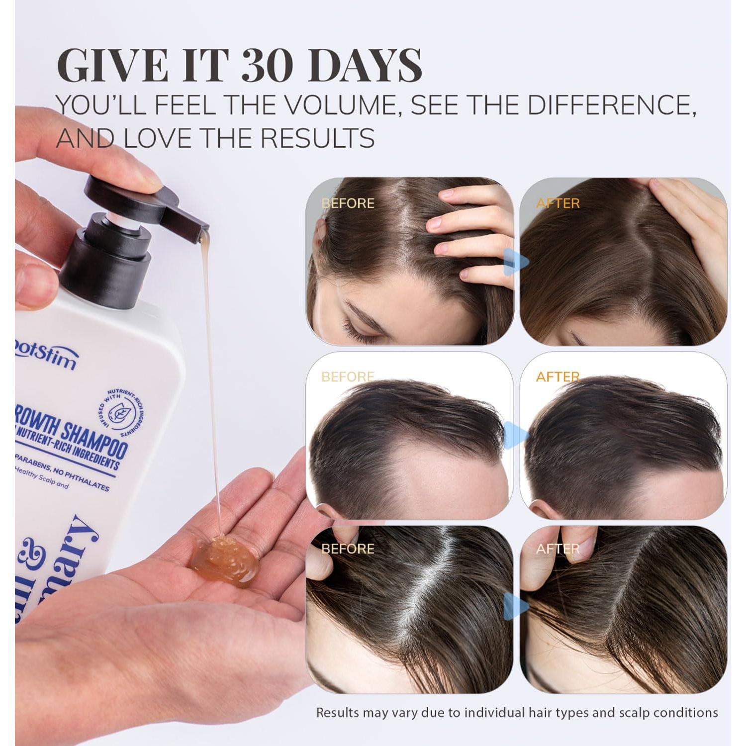 Champú de Biotina y Romero RootStim 295 ml para Crecimiento Cabello