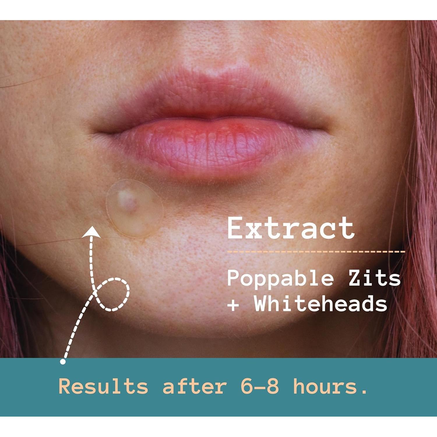 Parche Hidrocoloide para Acné - Ácido Salicílico - 81 Unidades